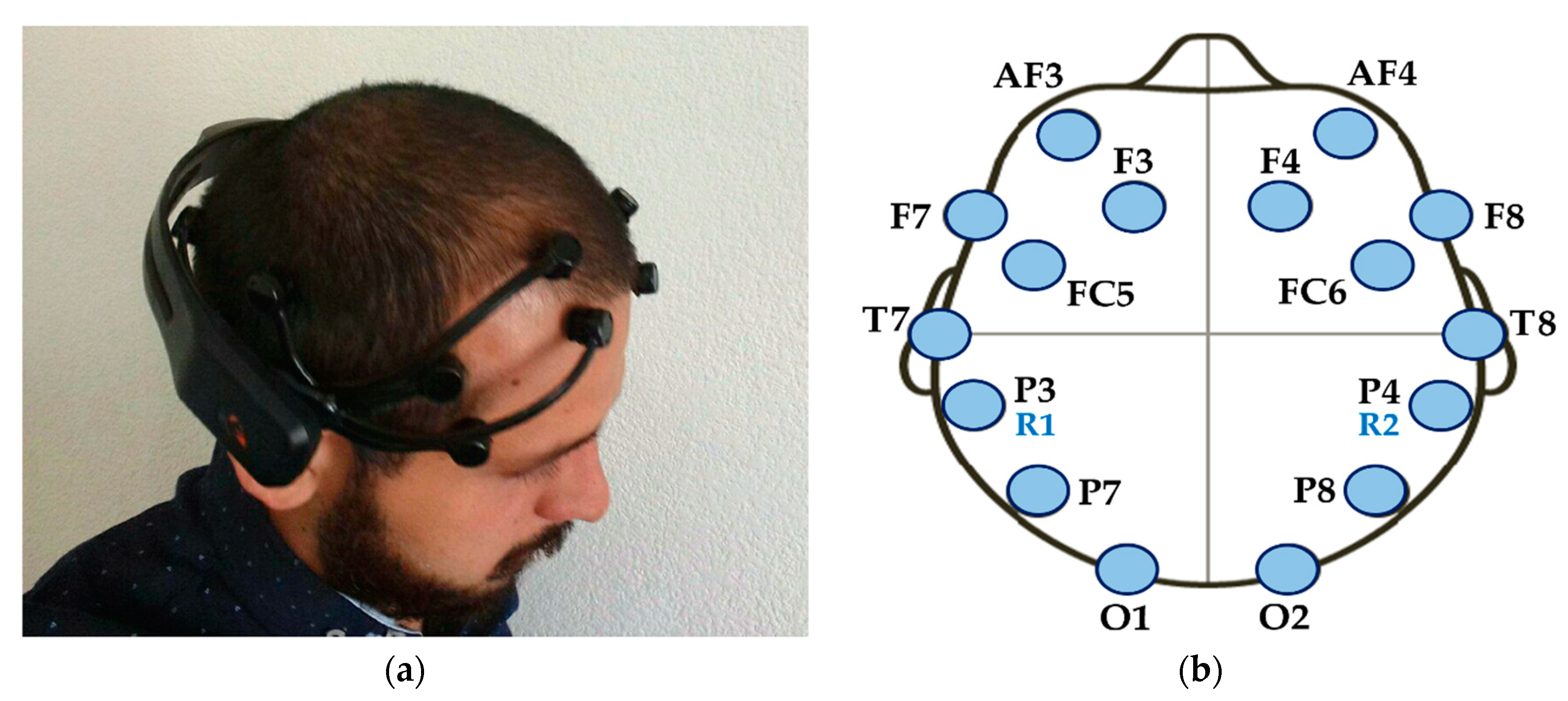 Sensors 18 01483 g001 Sensors 18 01483 g001
