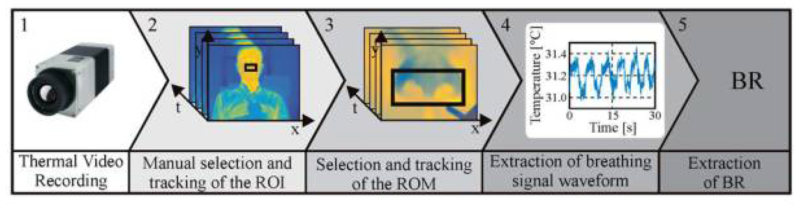 Sensors 18 01618 g002