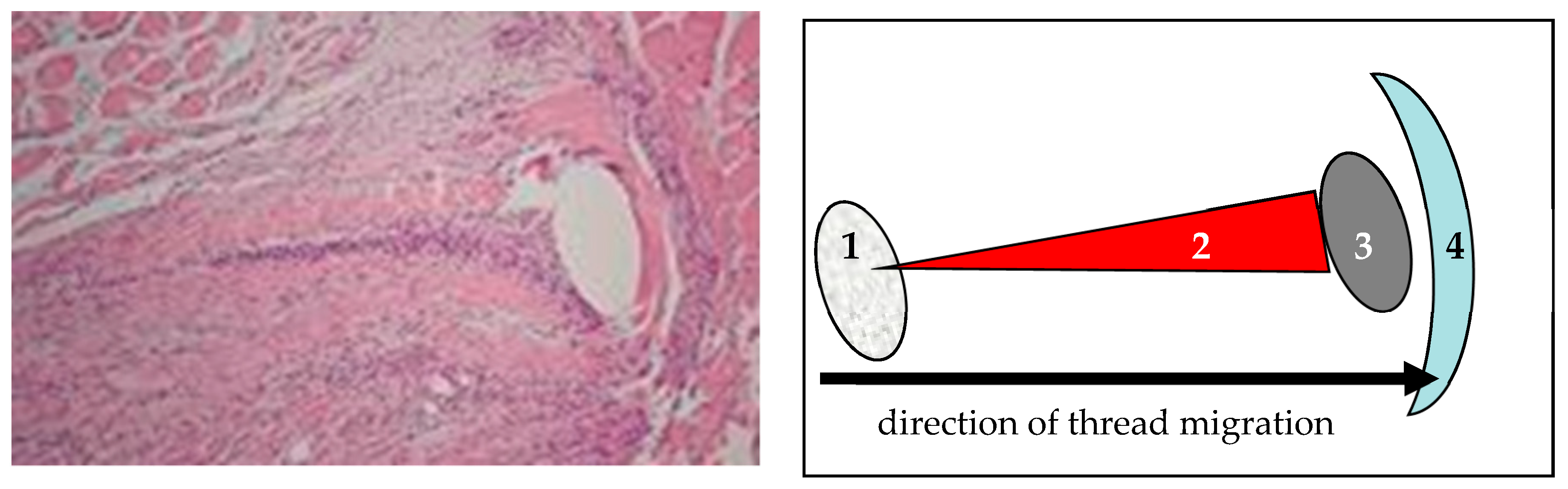 Sensors 18 01729 g007