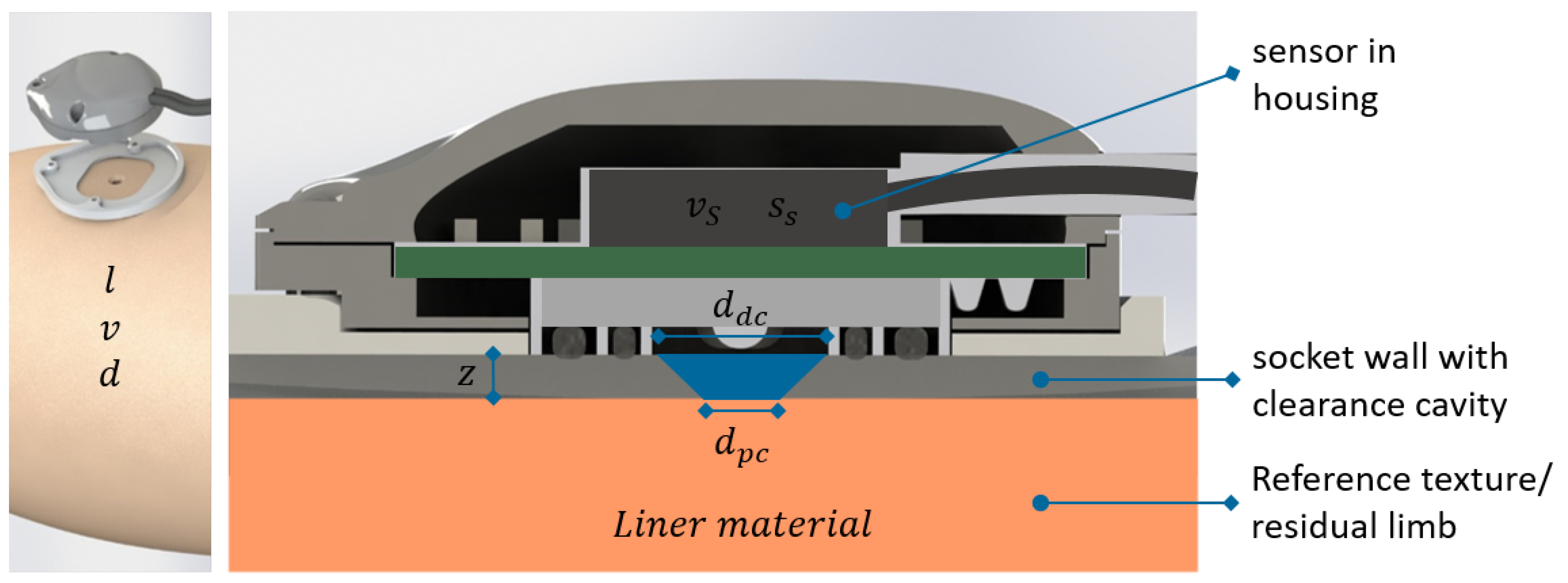 Sensors 18 02170 g003 Sensors 18 02170 g003