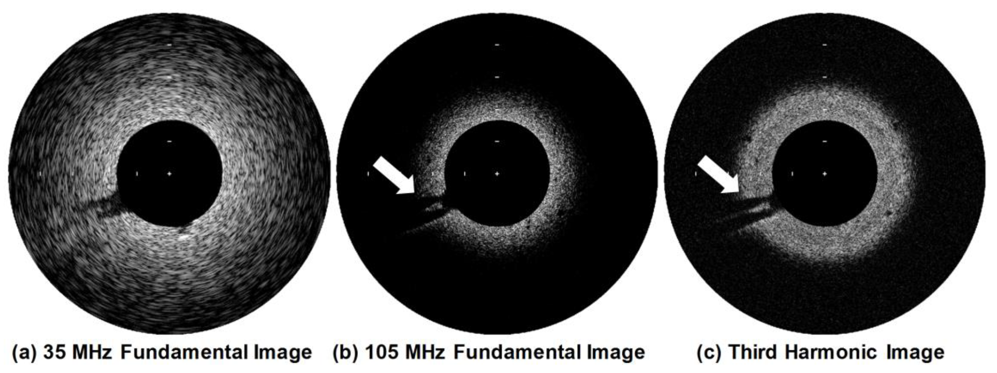 Sensors 18 02290 g012