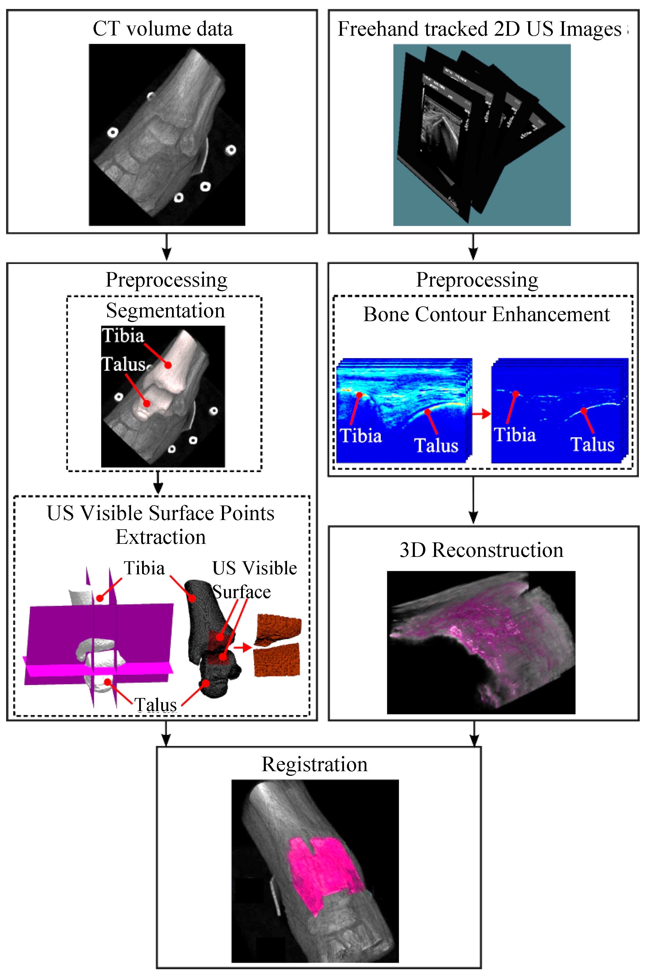 Sensors 18 02375 g001