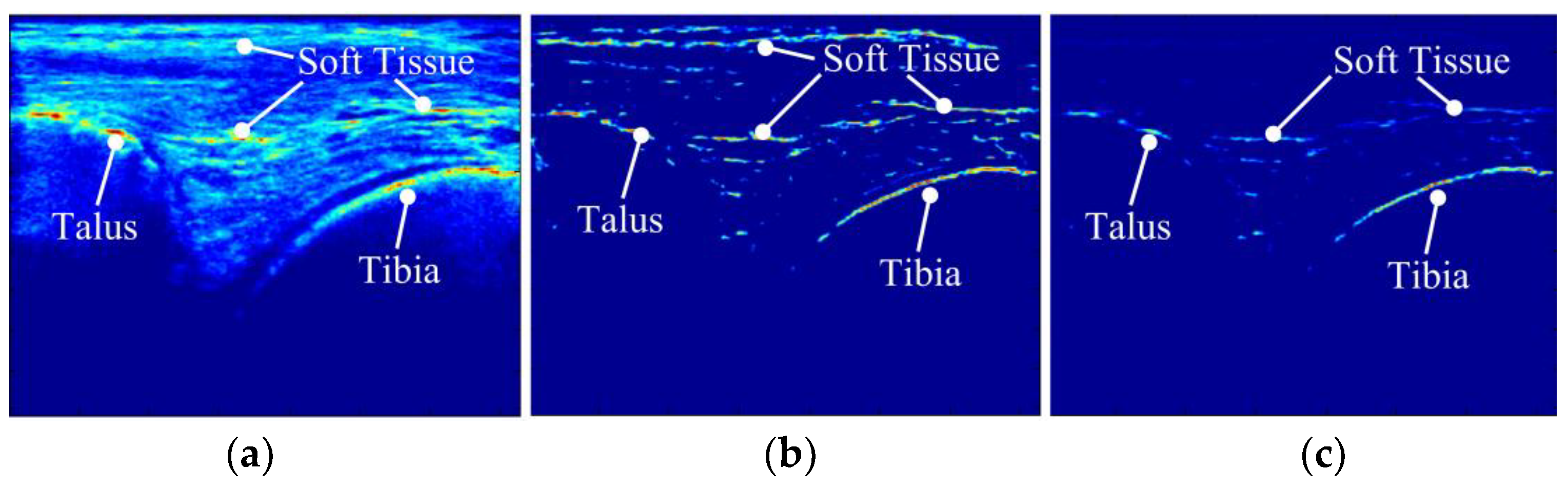 Sensors 18 02375 g003
