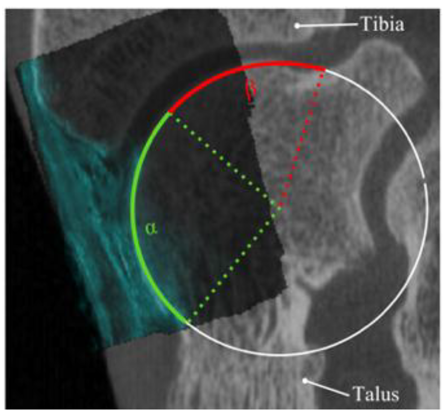 Sensors 18 02375 g004