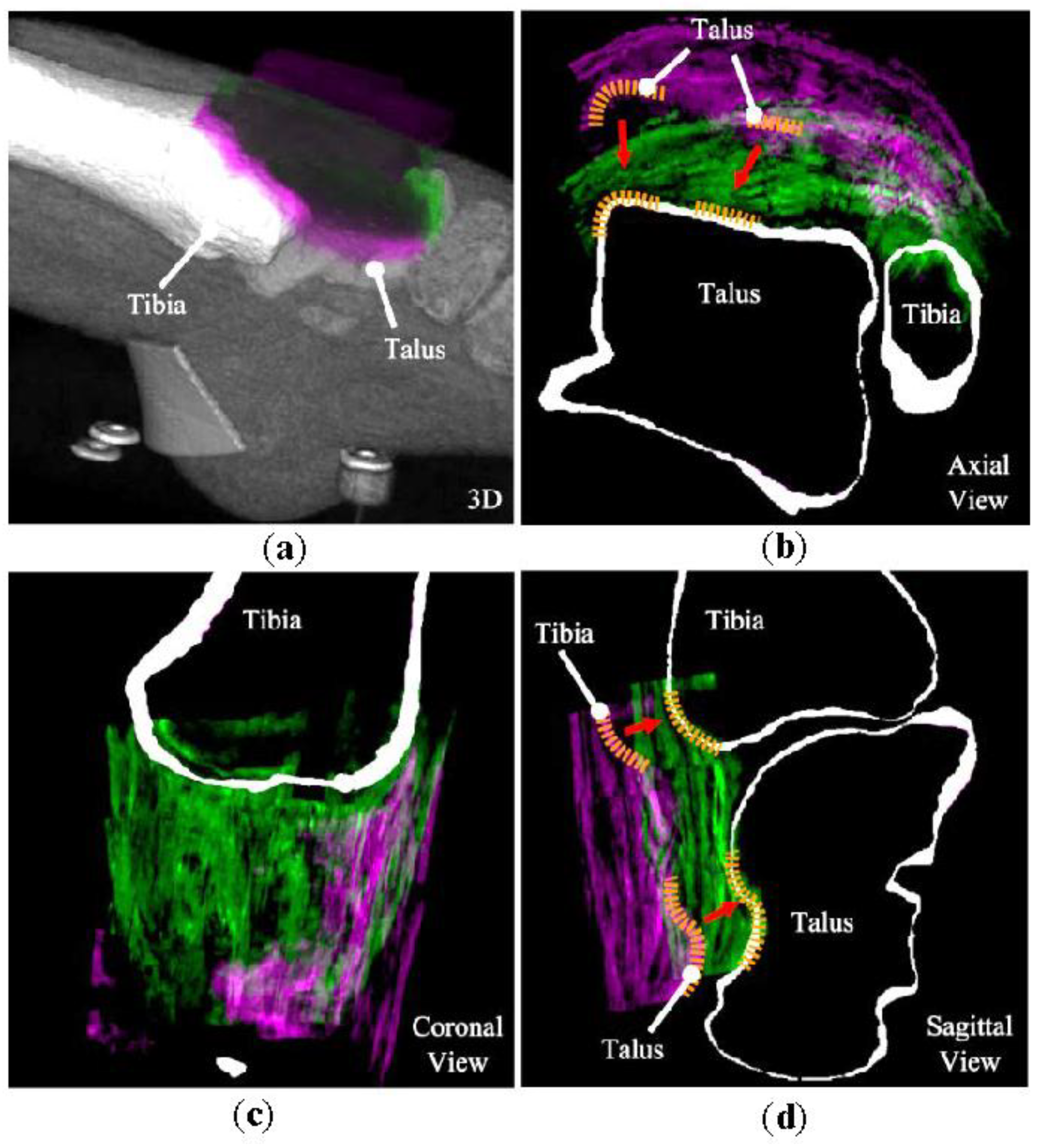 Sensors 18 02375 g005