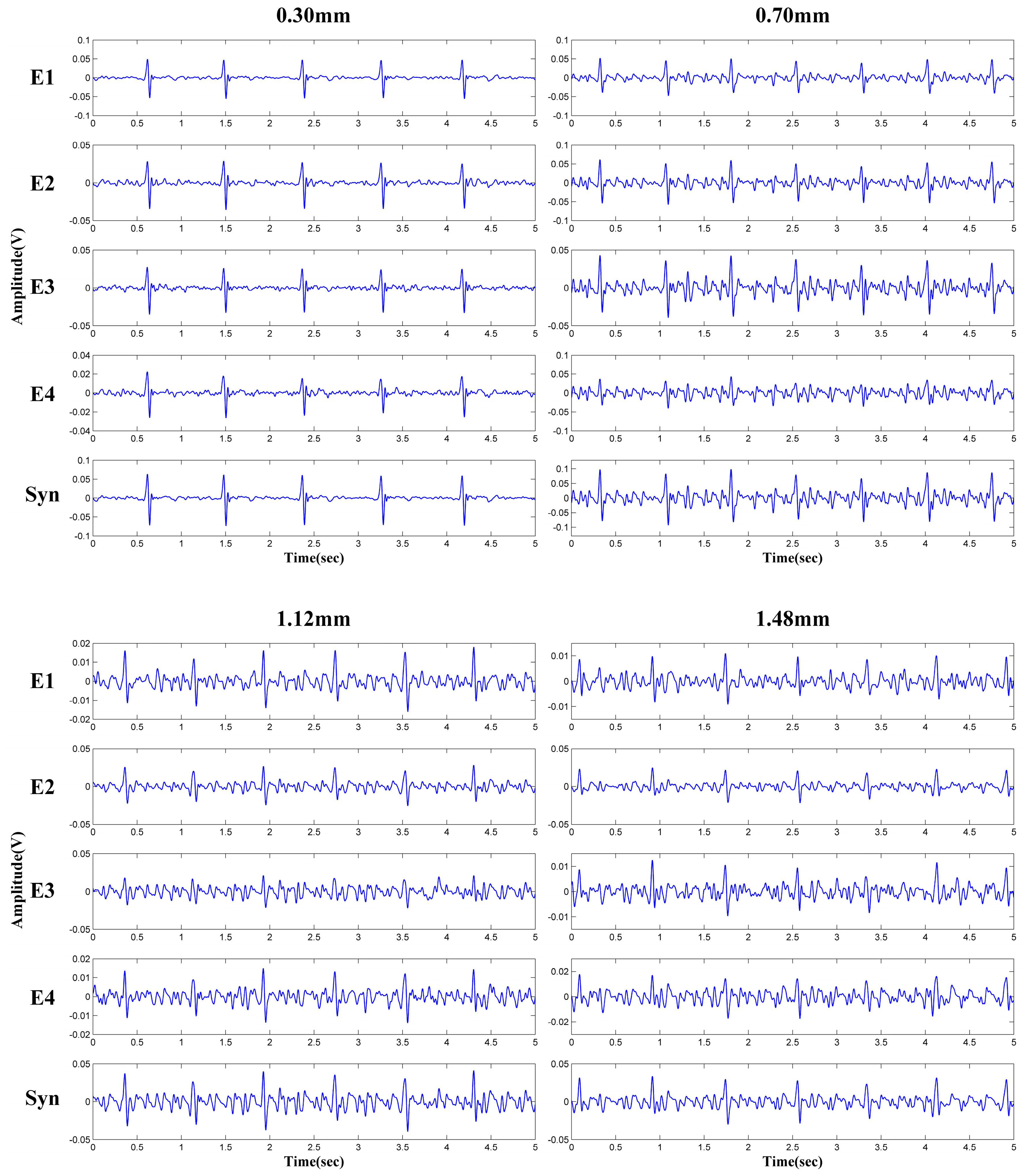 Sensors 18 02835 g011