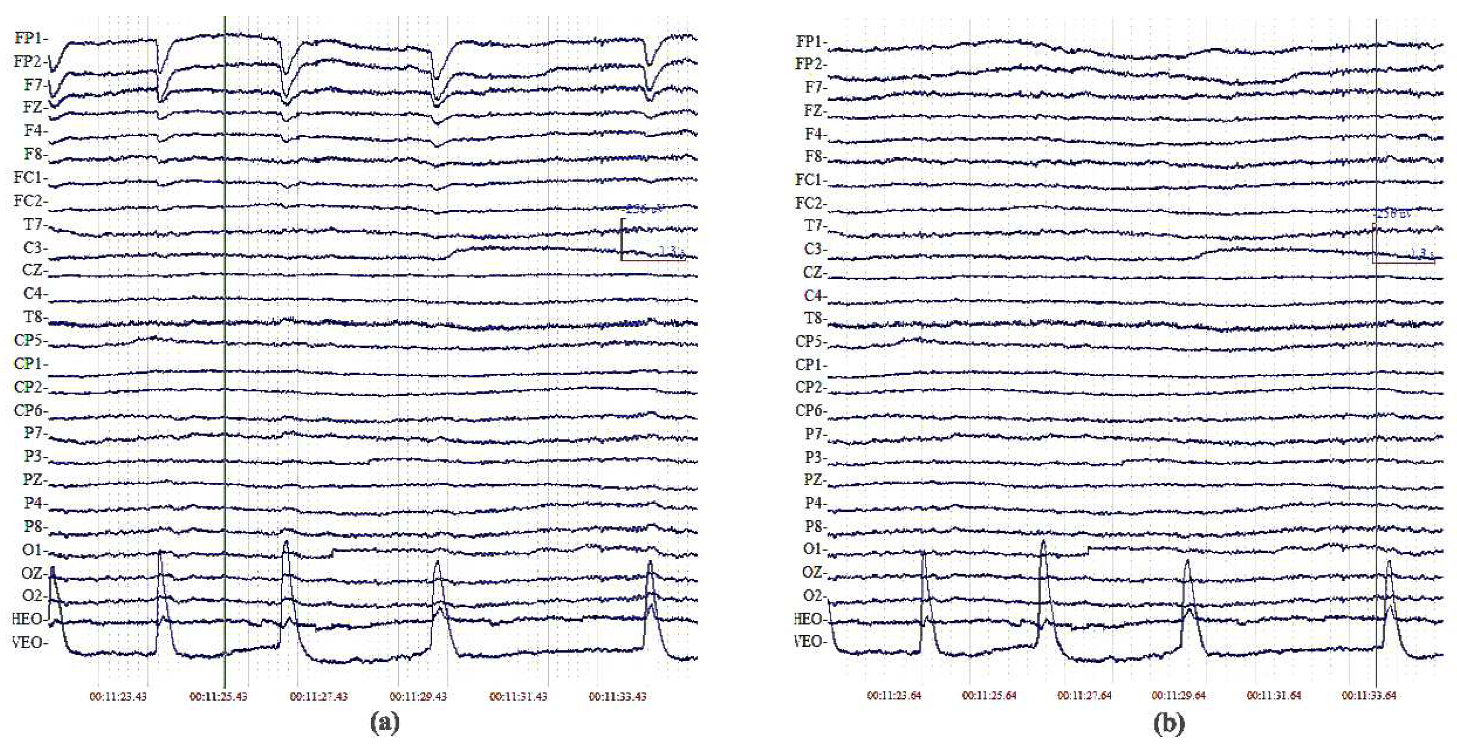 Sensors 18 02920 g001