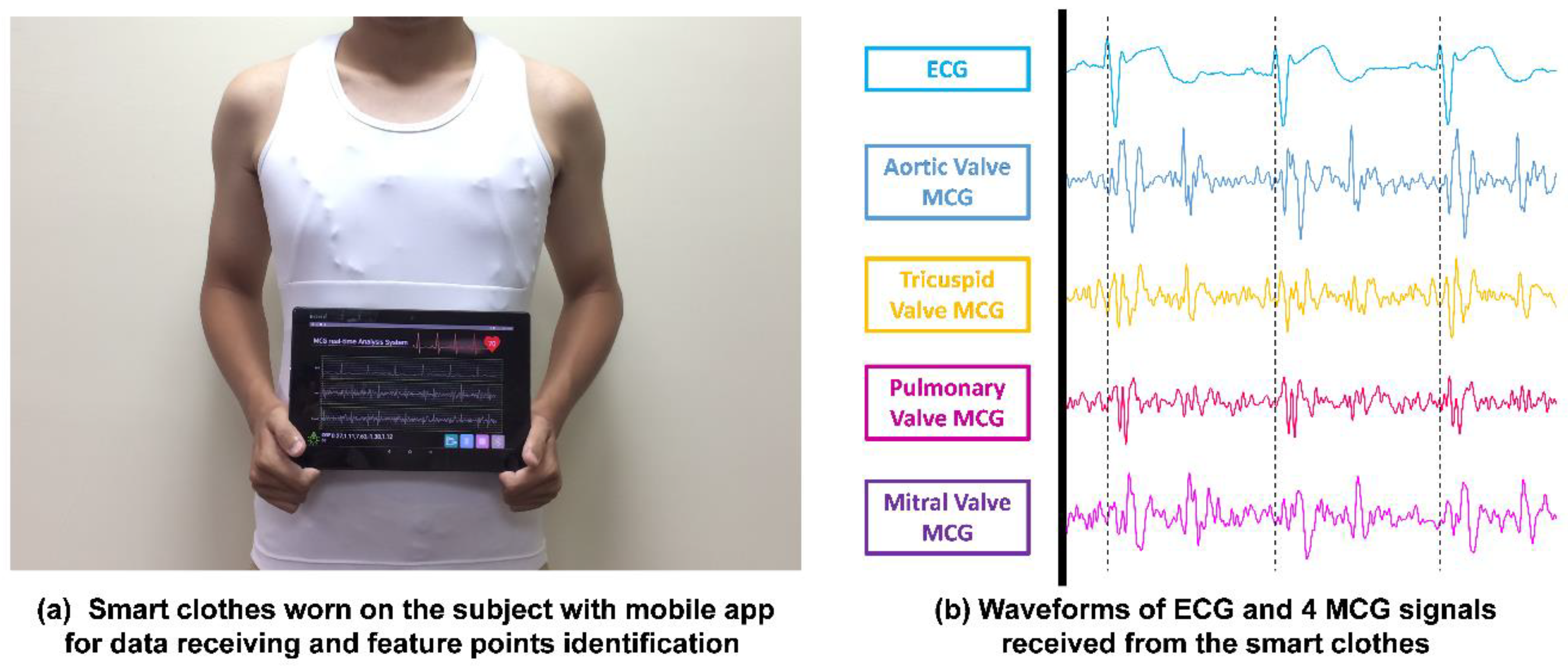 Sensors 18 03538 g010