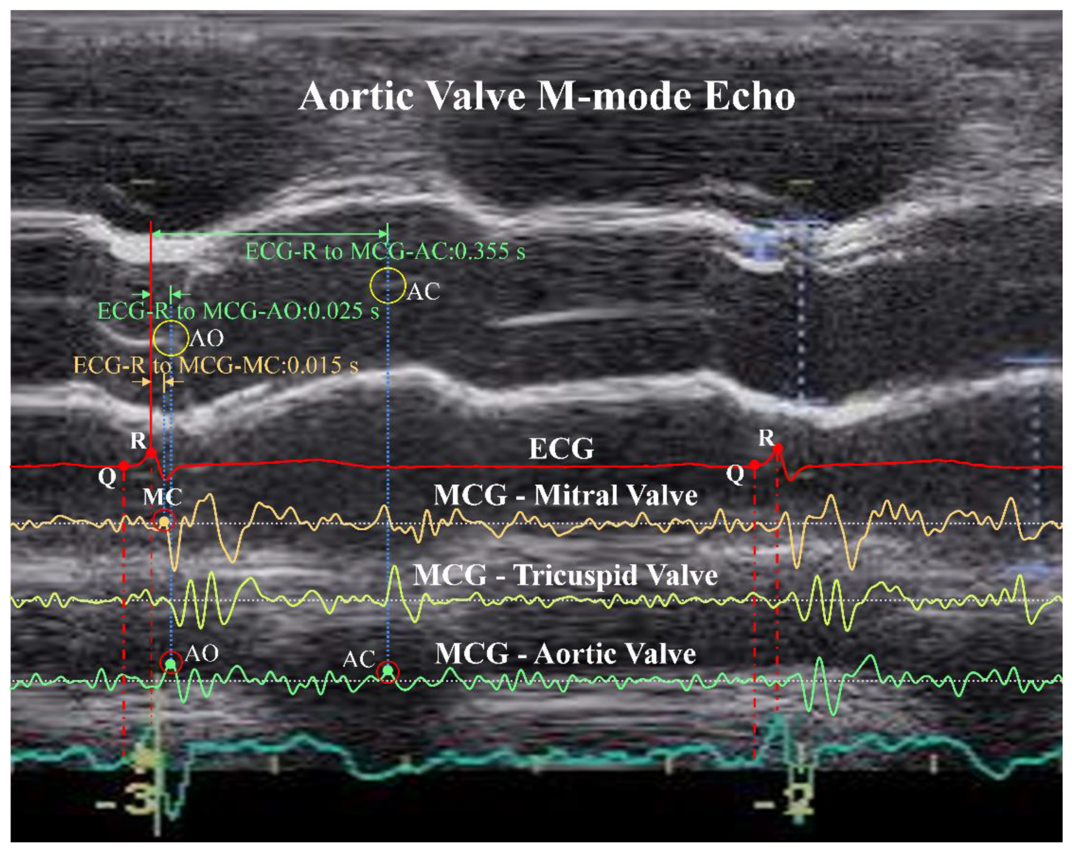 Sensors 18 03538 g011