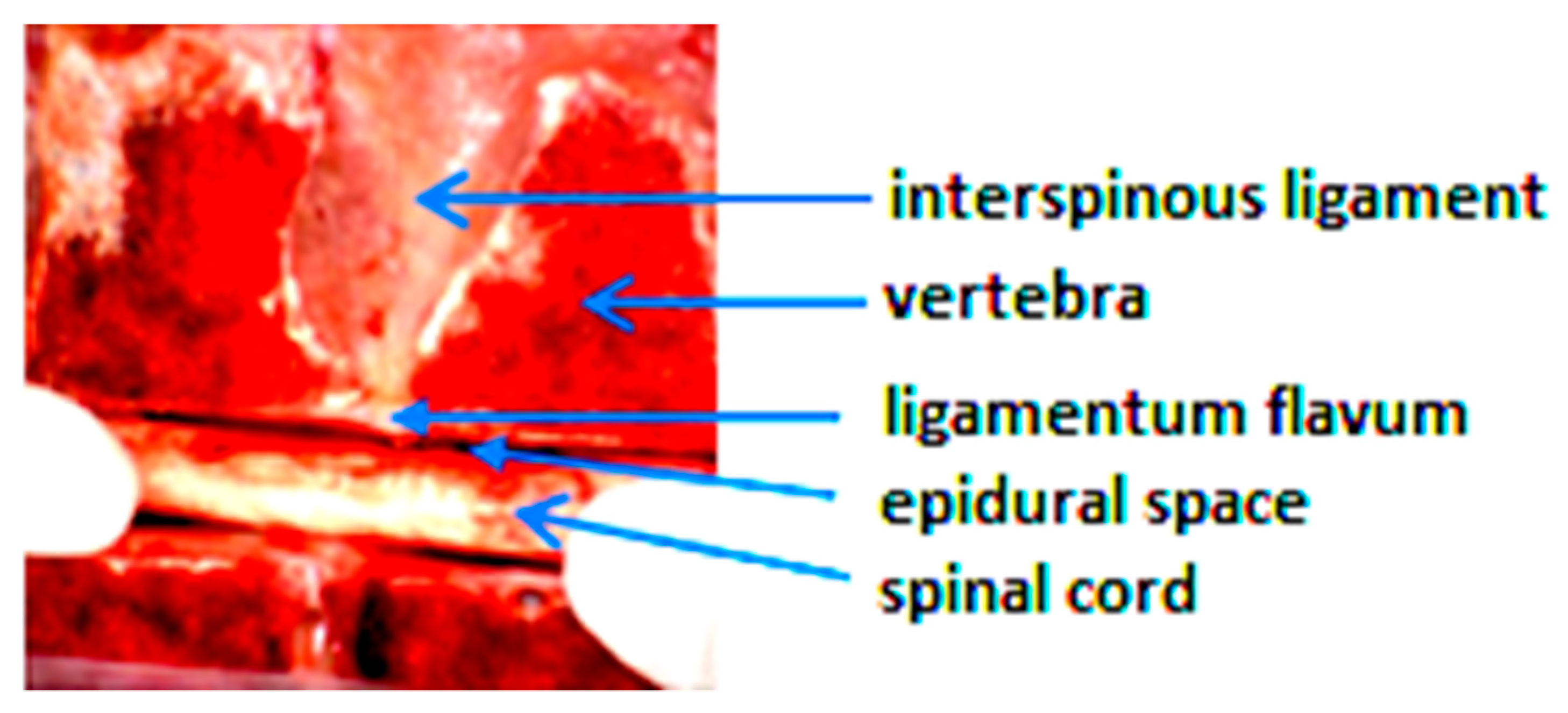 Sensors 18 03592 g001