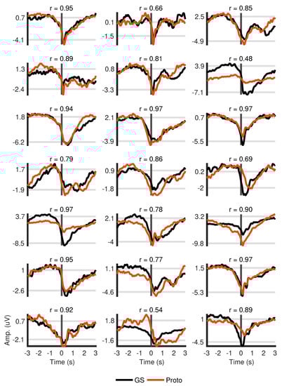 Sensors 18 03721 g0a1