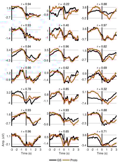 Sensors 18 03721 g0a2