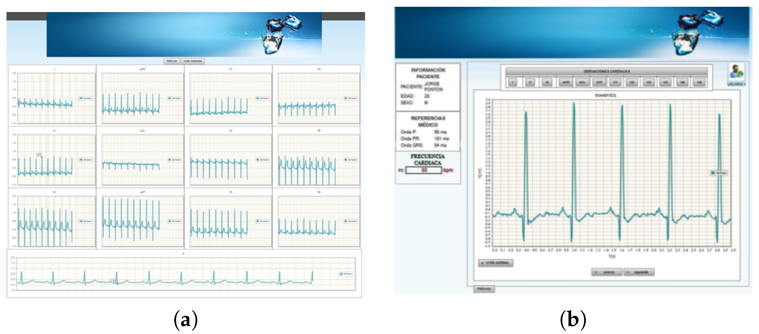 Sensors 18 03773 g007 Sensors 18 03773 g007