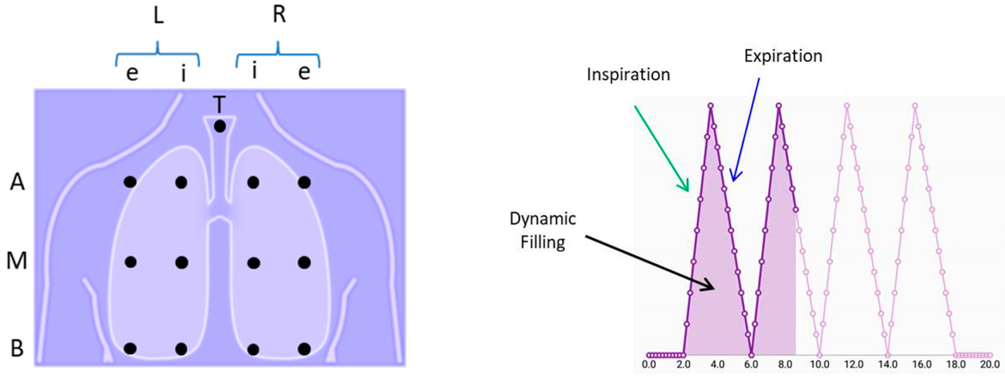 Sensors 18 03813 g004