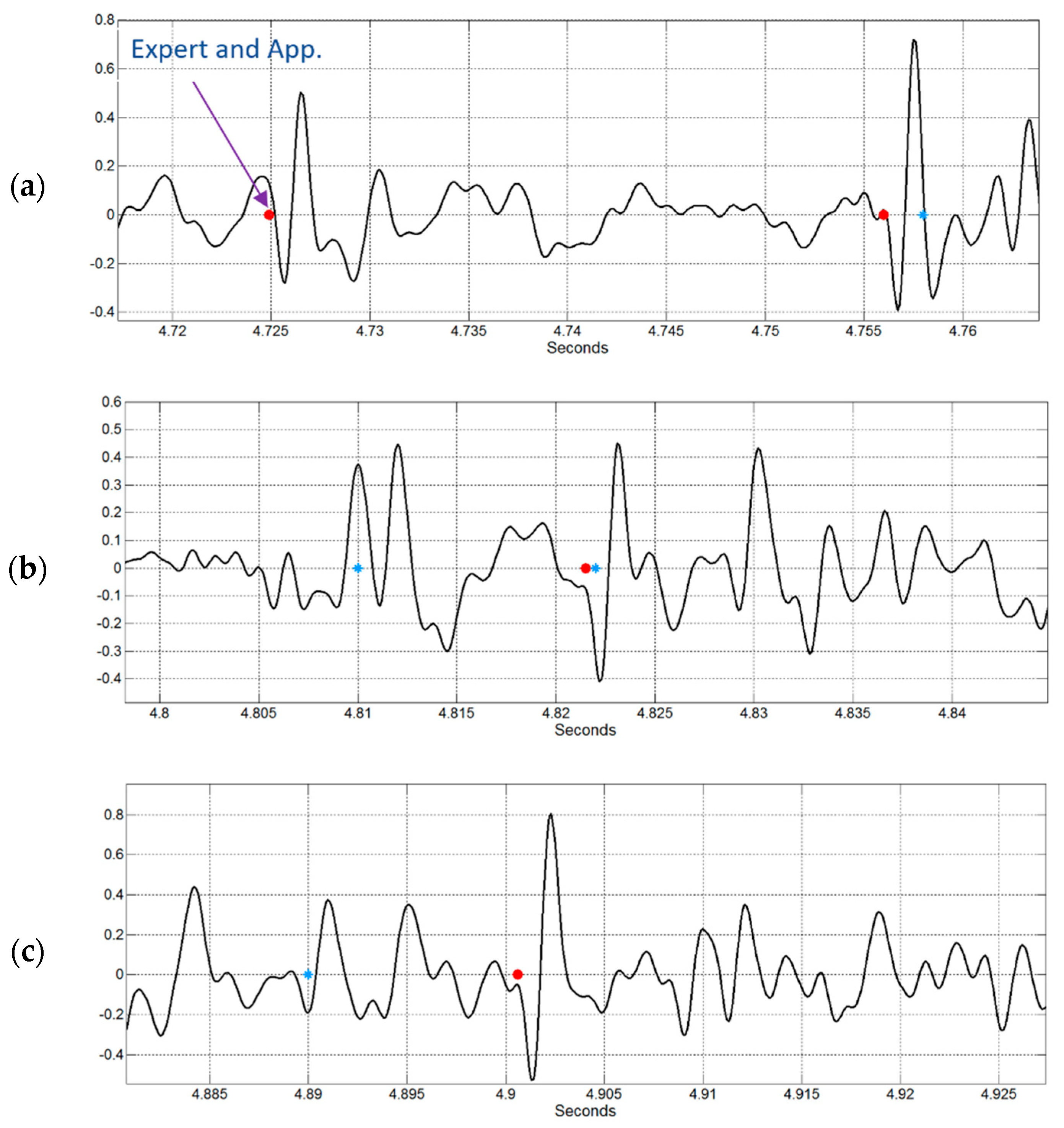 Sensors 18 03813 g011