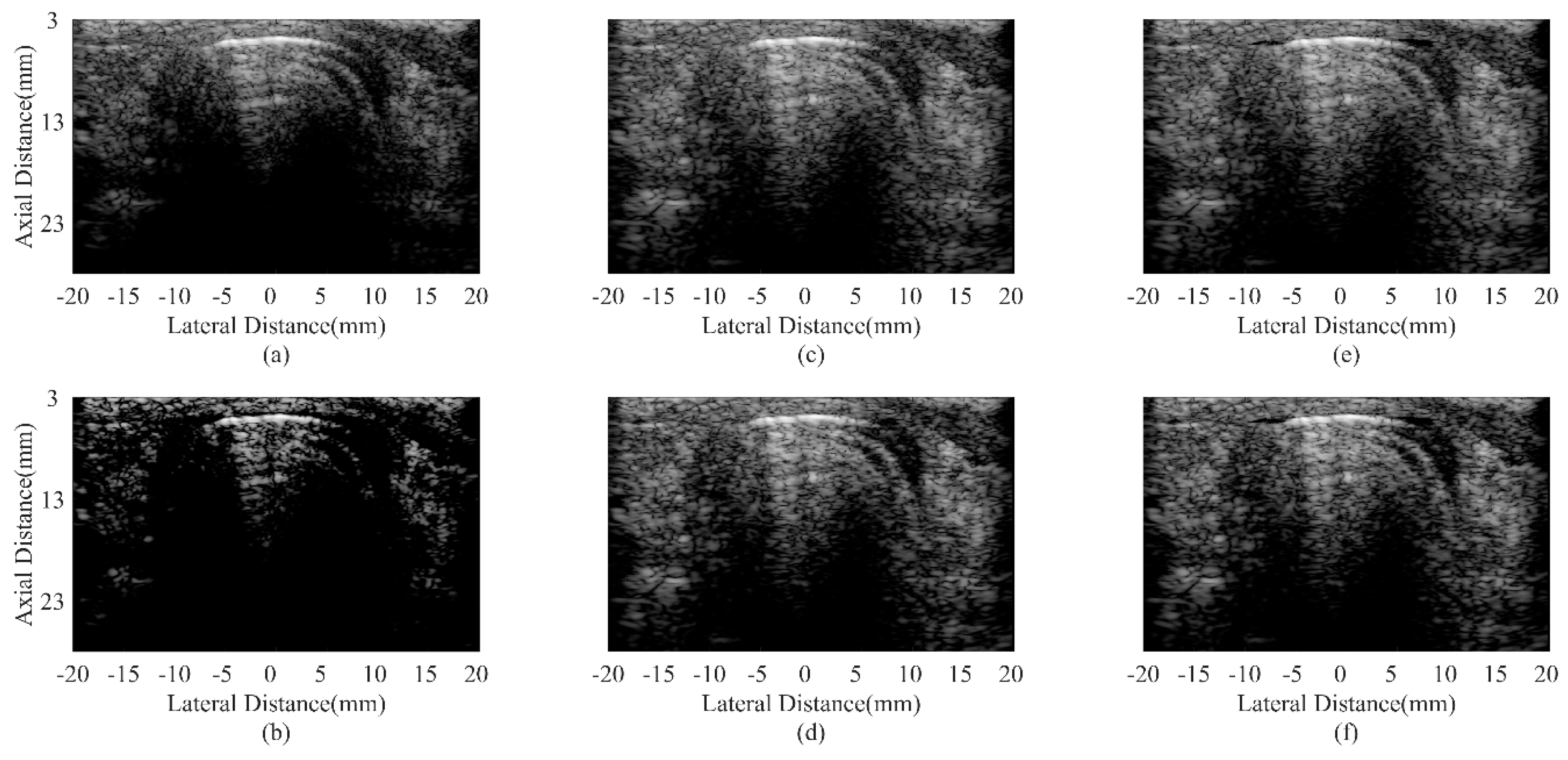 Sensors 18 04099 g010