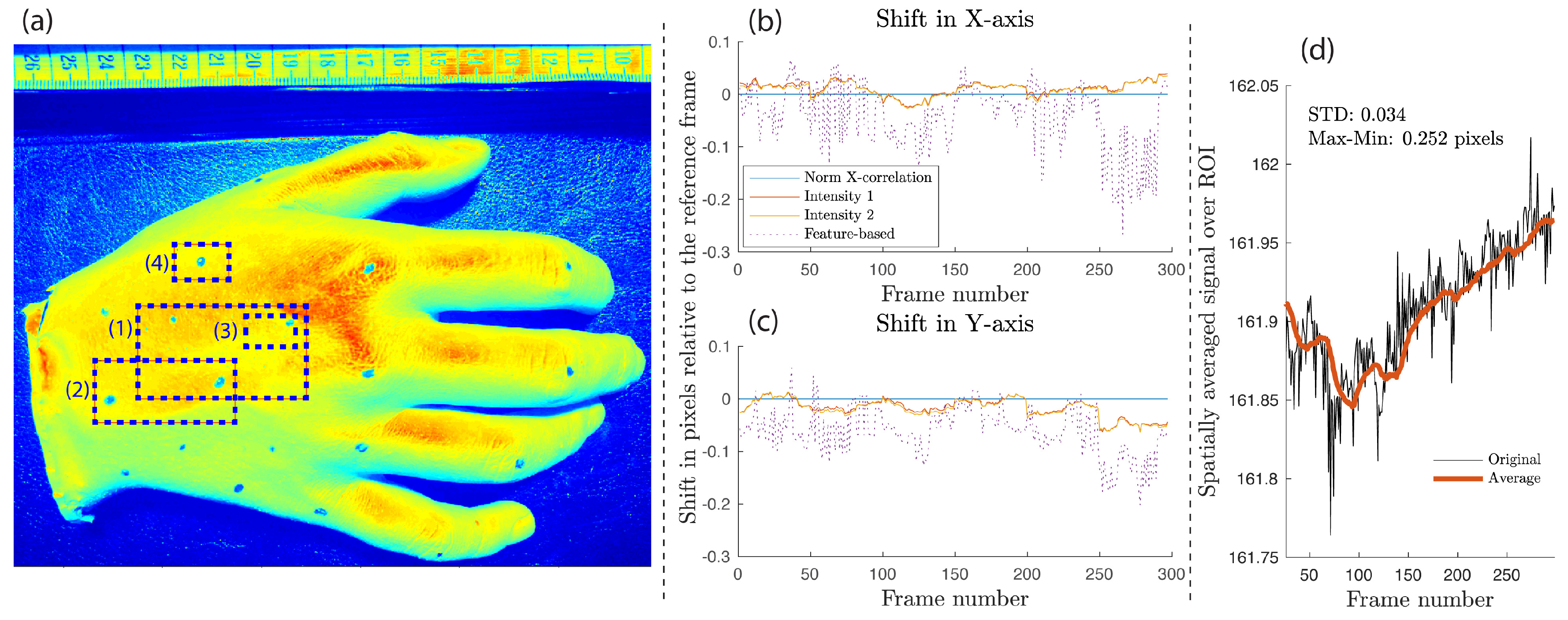Sensors 18 04340 g007