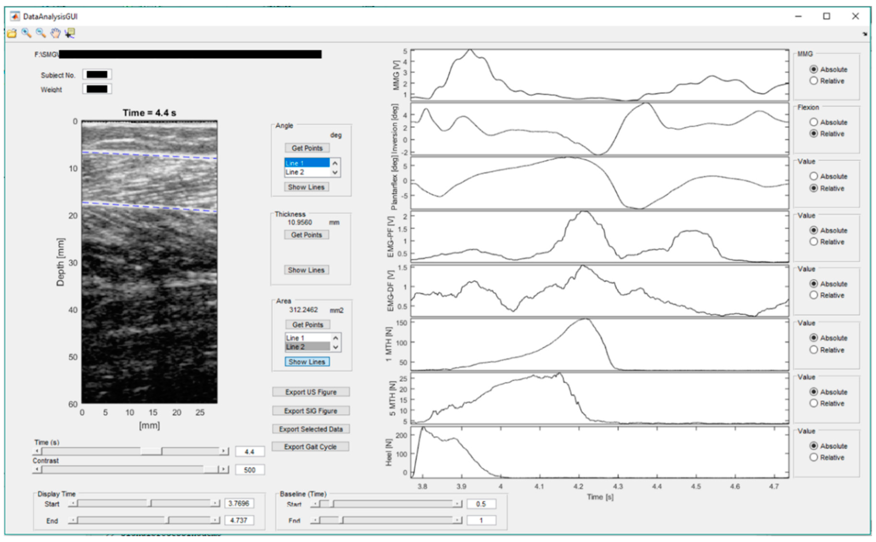 Sensors 19 00195 g003