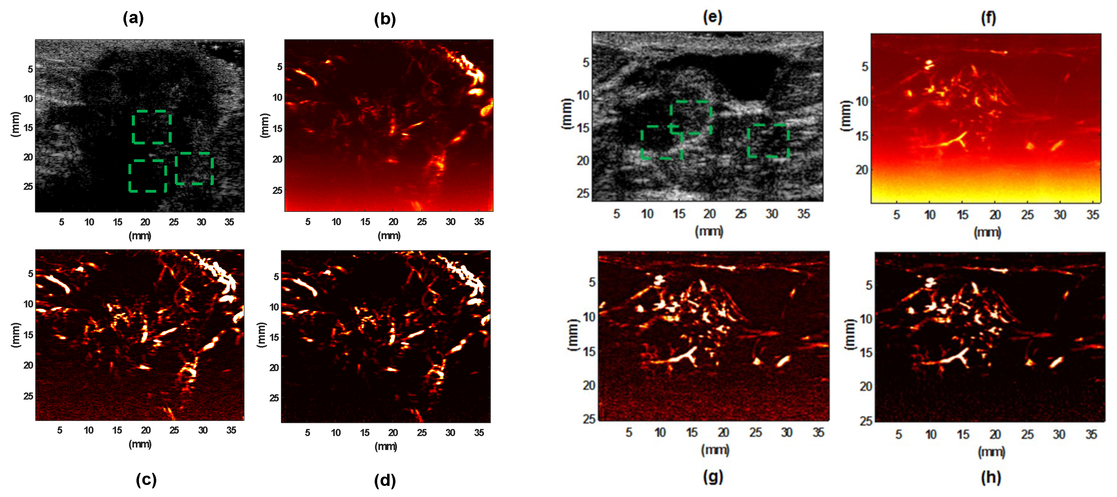 Sensors 19 00245 g006