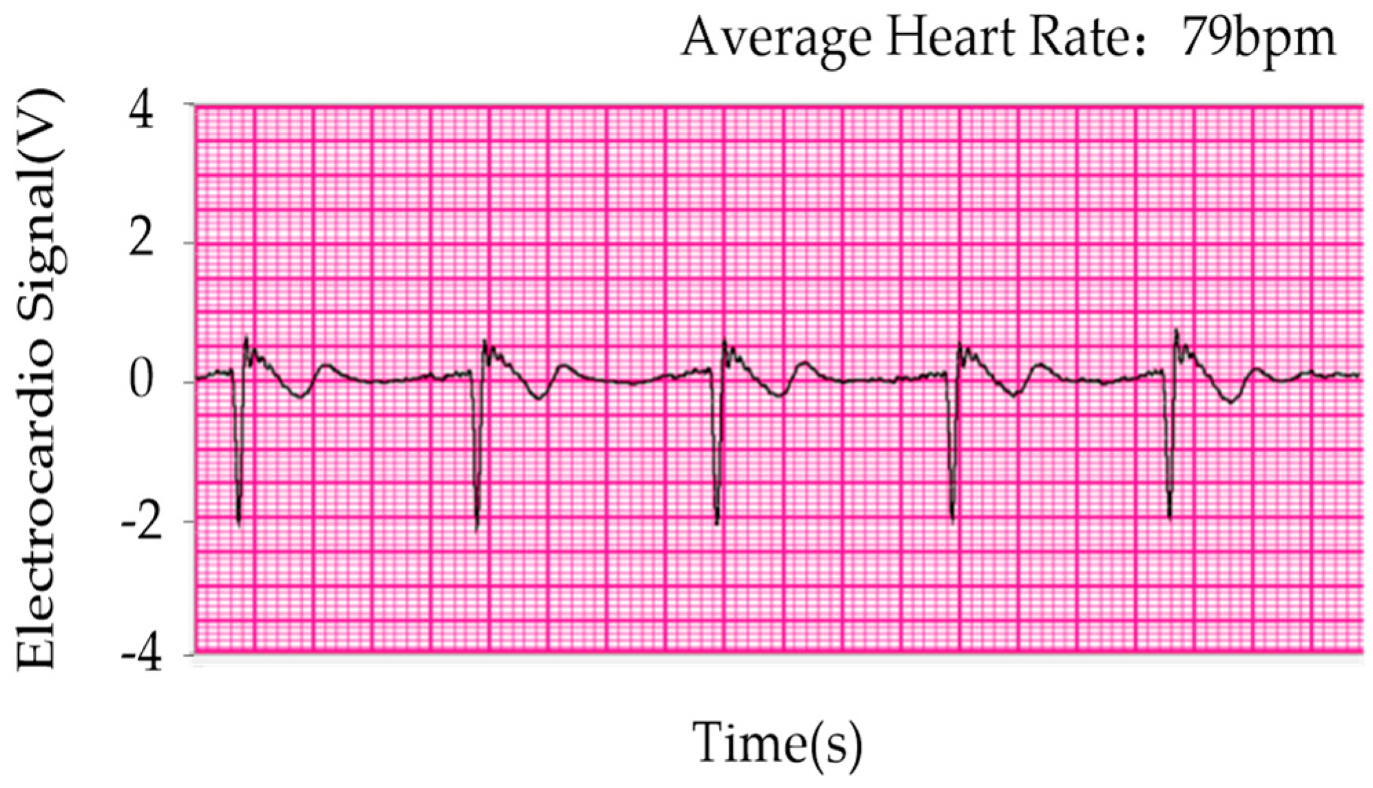 Sensors 19 00368 g012