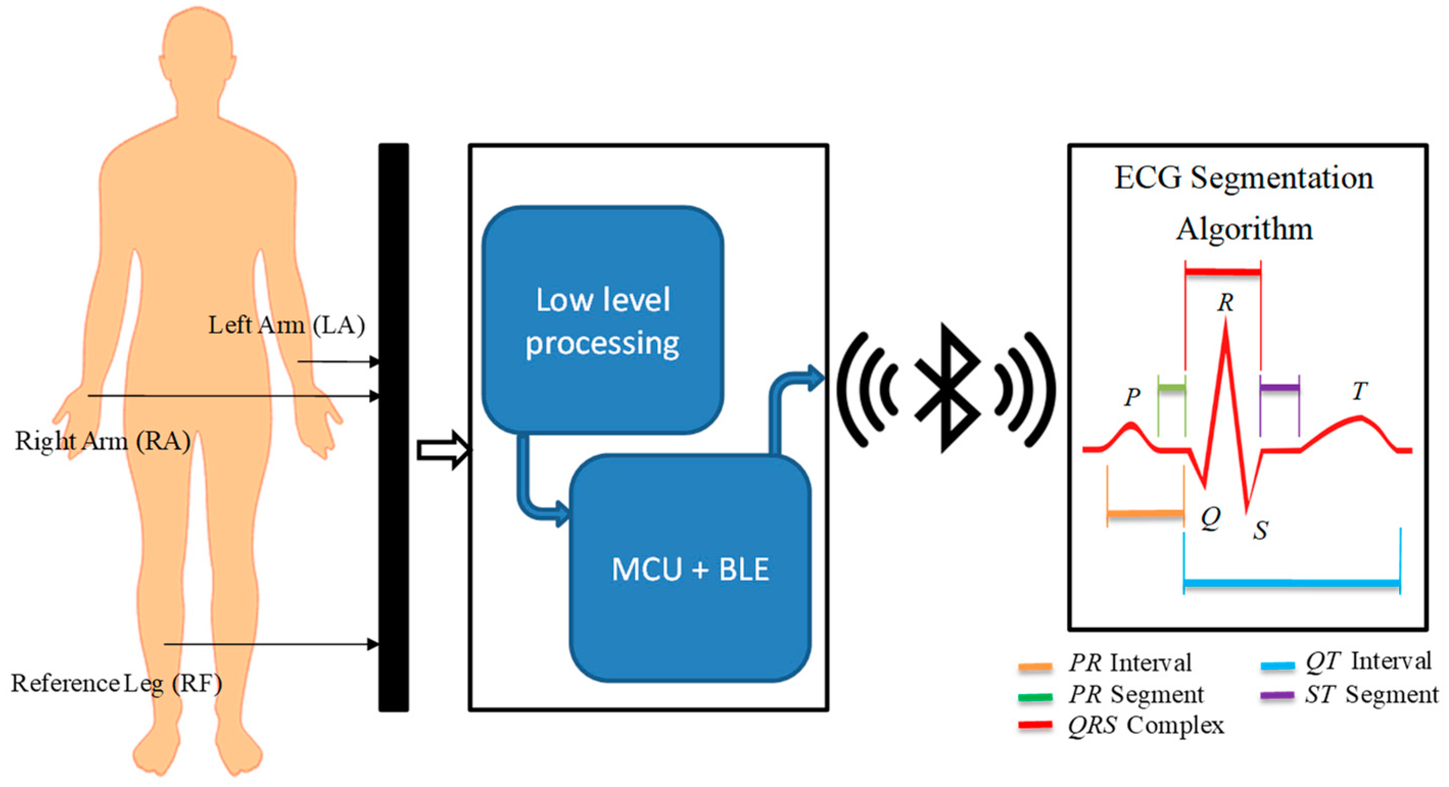 Sensors 19 00775 g002