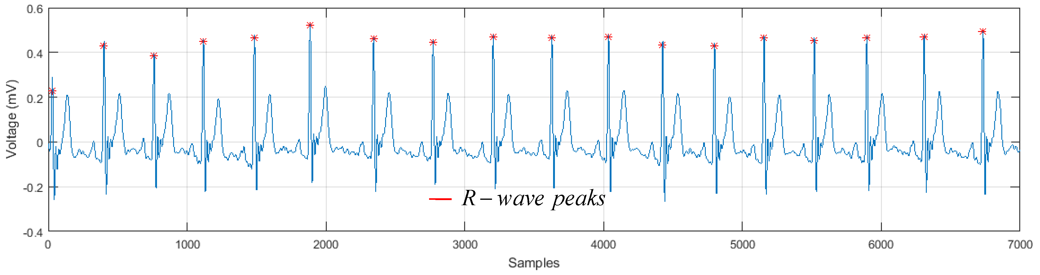 Sensors 19 00775 g008