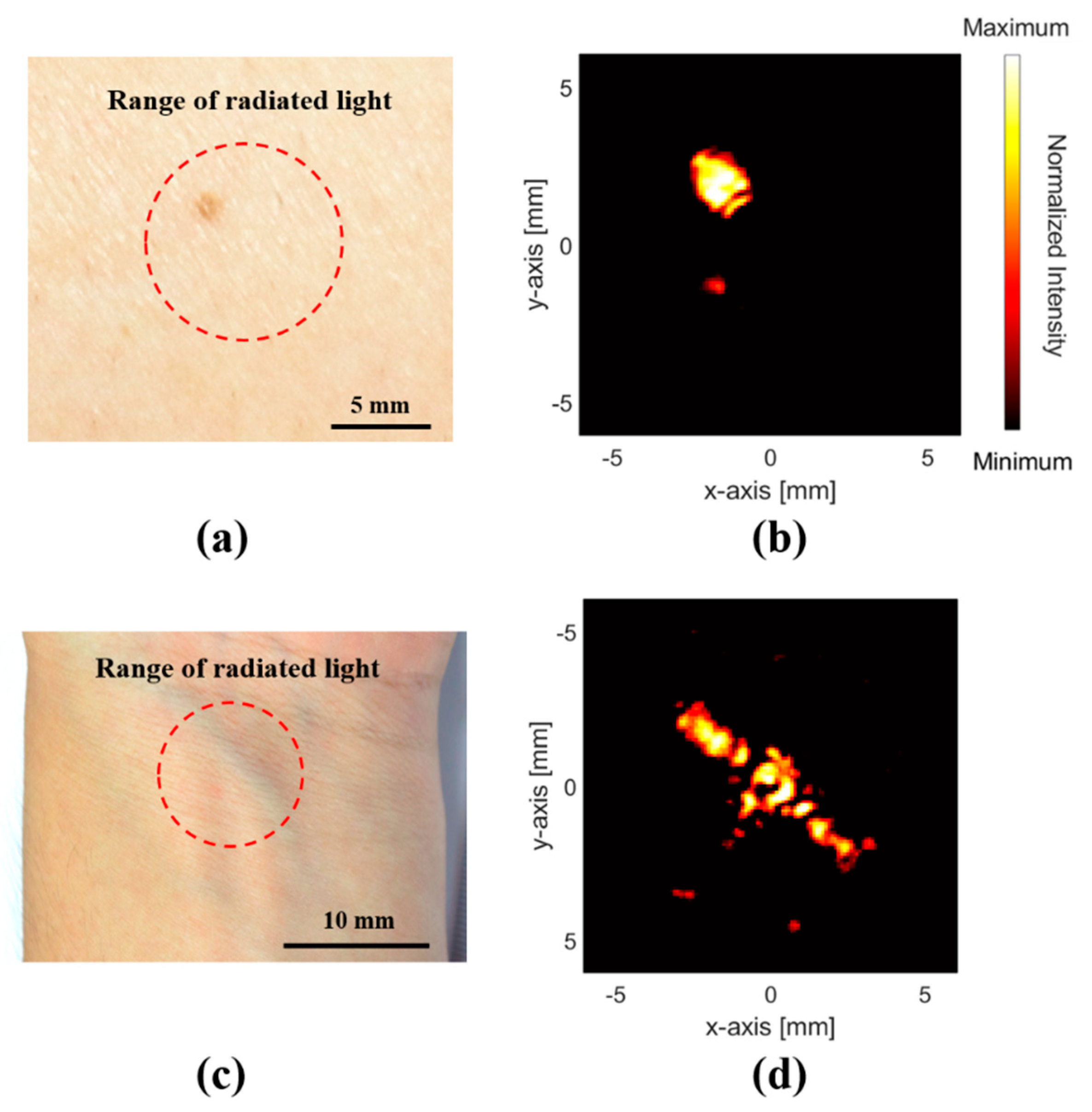 Sensors 19 00995 g006 Sensors 19 00995 g006
