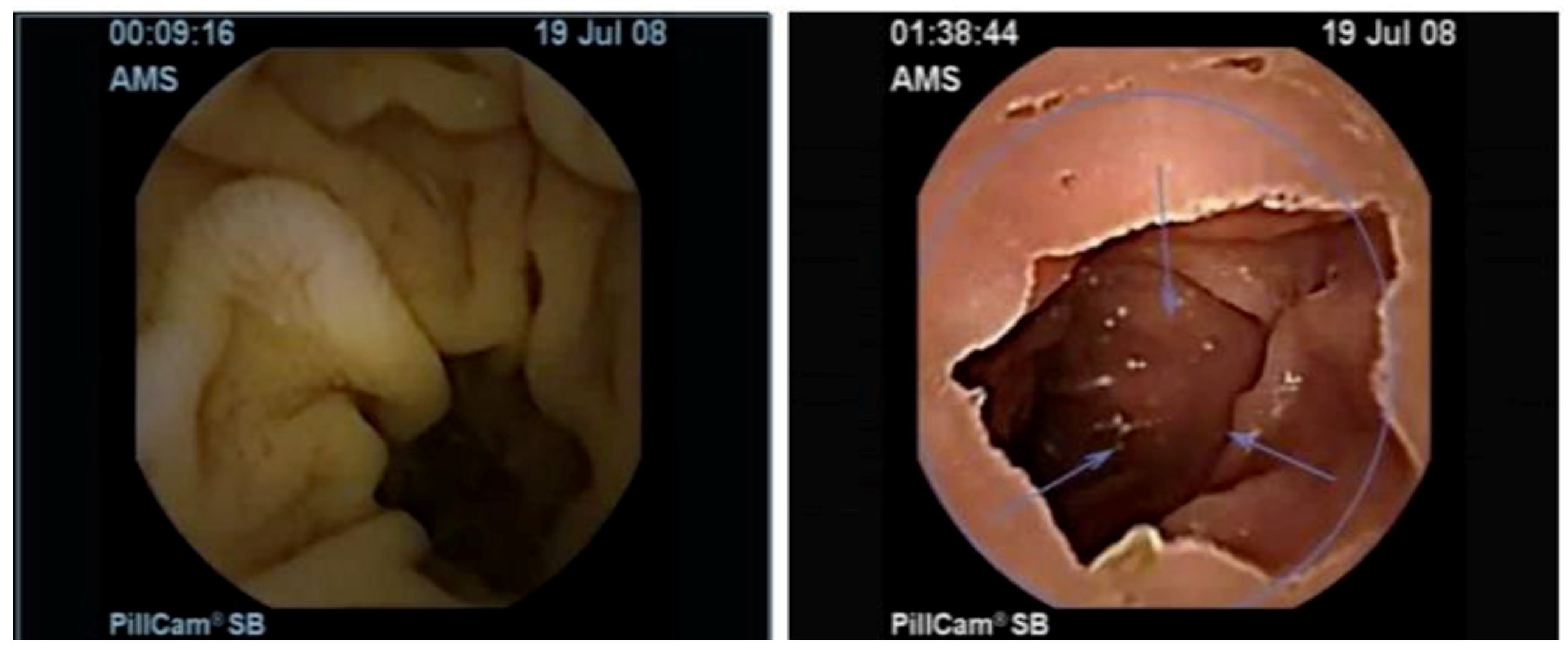 Sensors 19 01265 g004