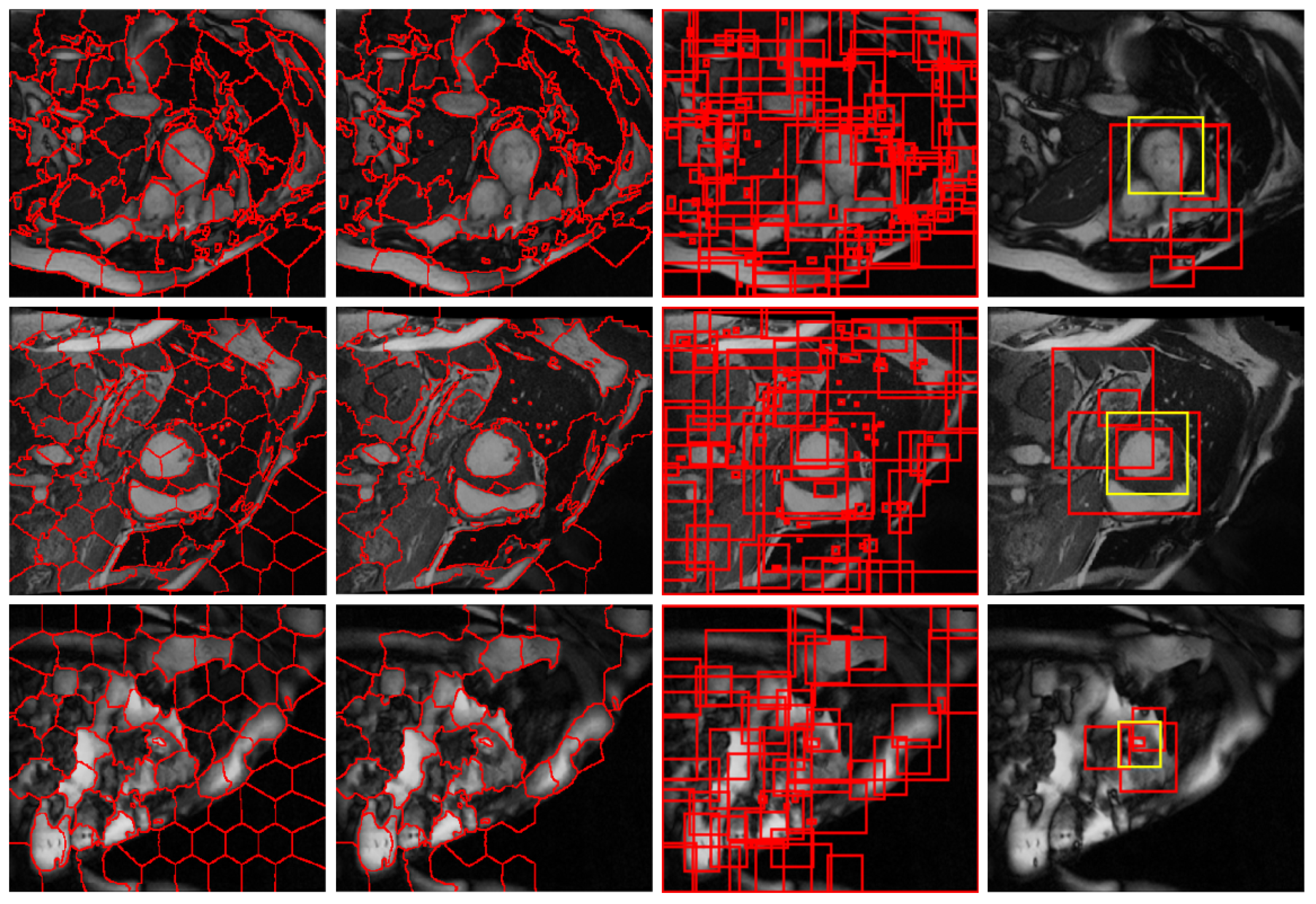 Sensors 19 01766 g002