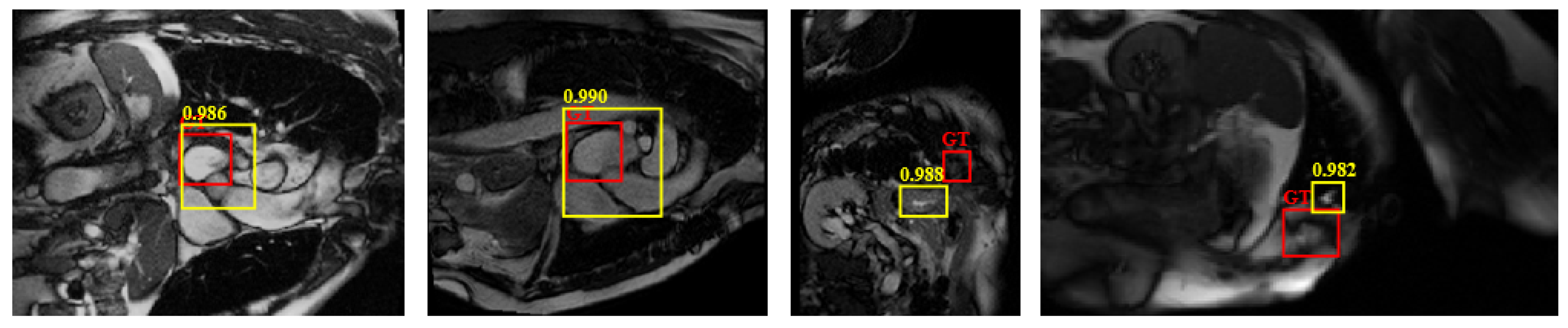 Sensors 19 01766 g011