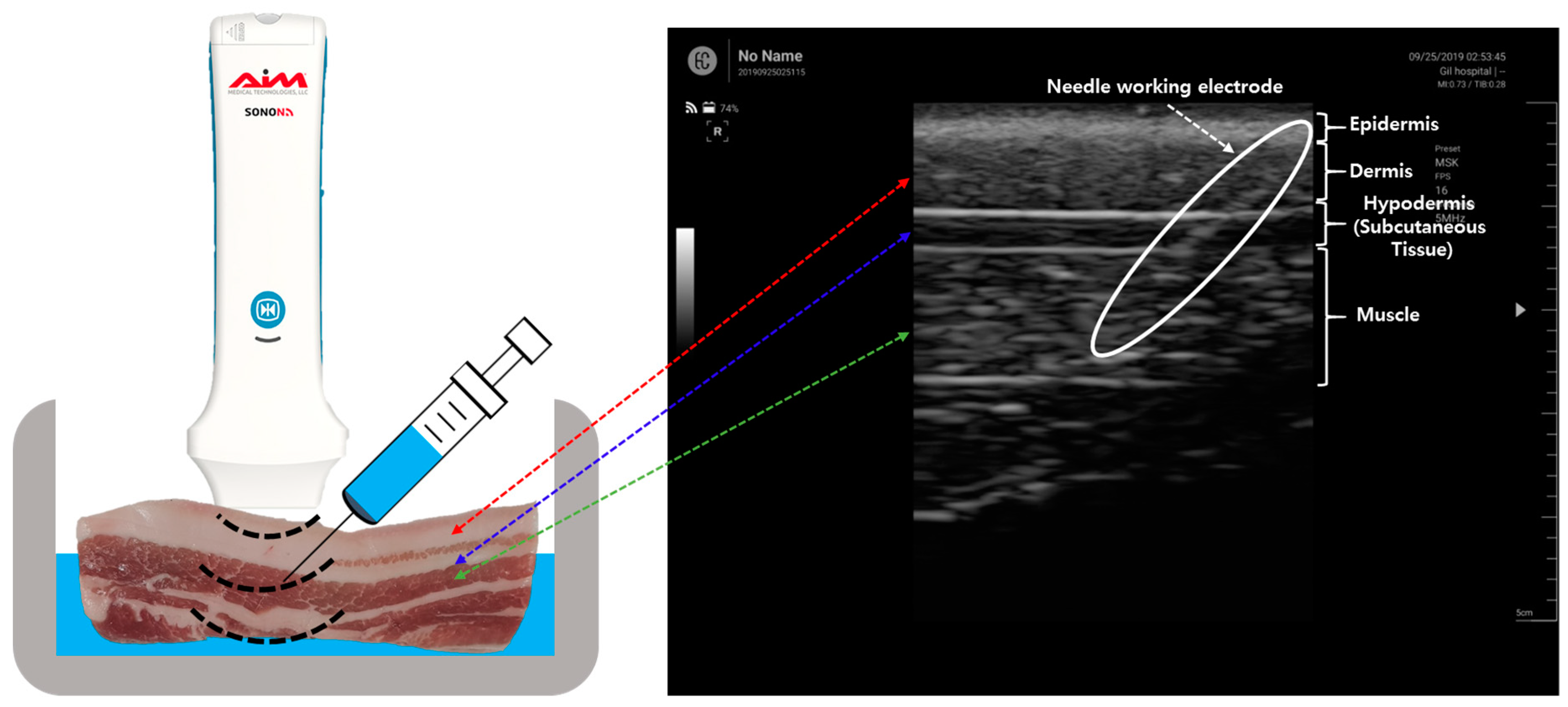 Sensors 19 04614 g003 Sensors 19 04614 g003