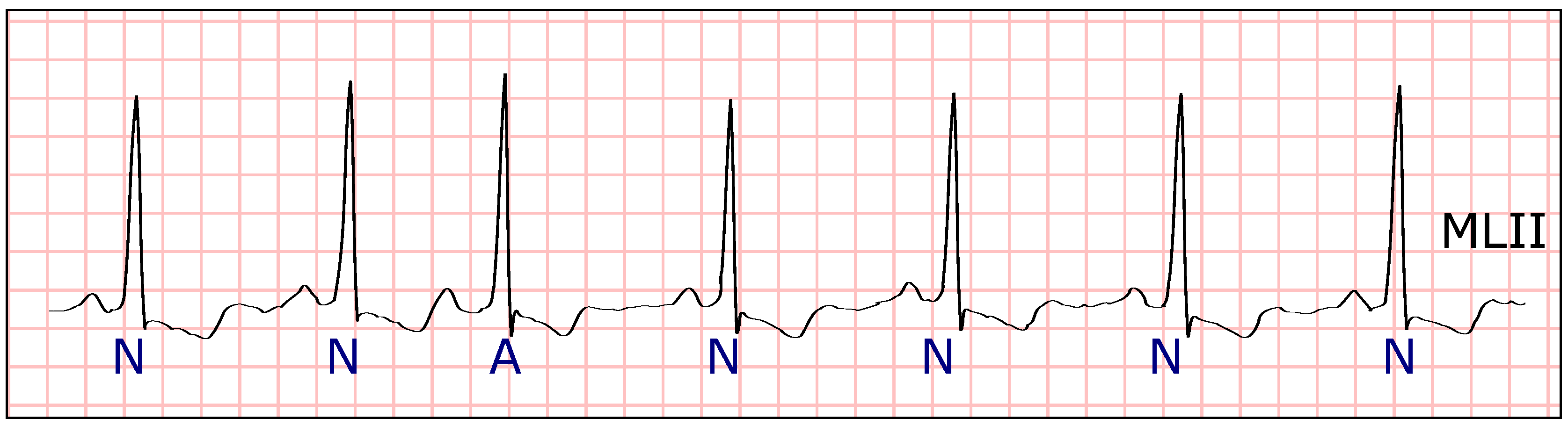Sensors 19 04635 g012