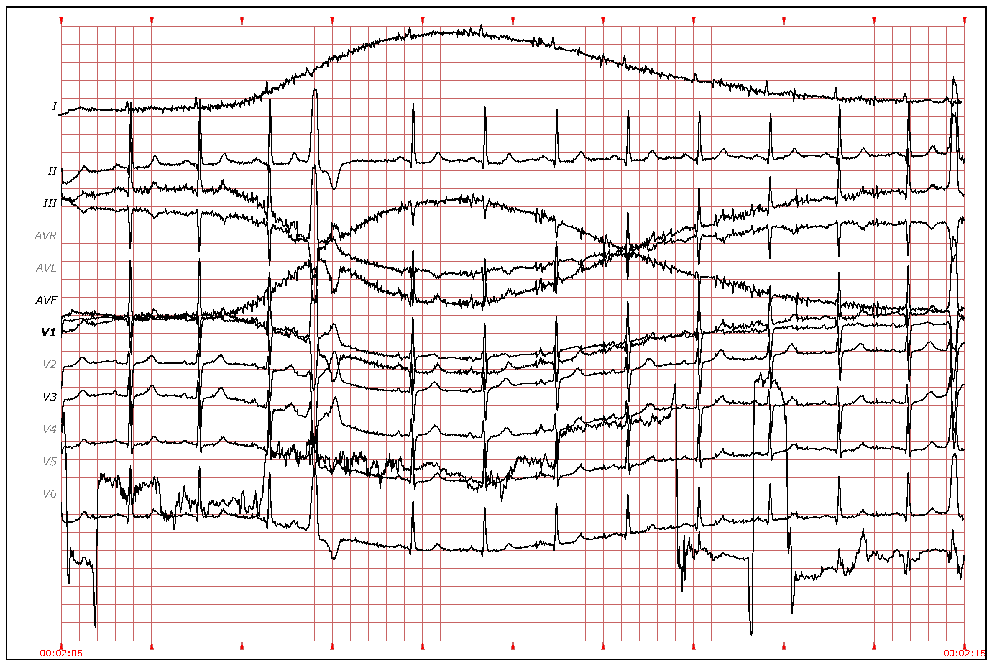 Sensors 19 04635 g014