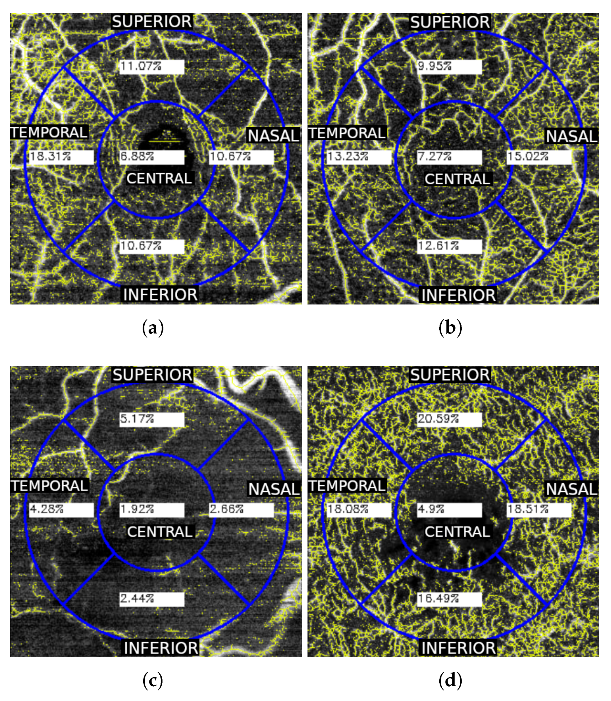 Sensors 19 04732 g006