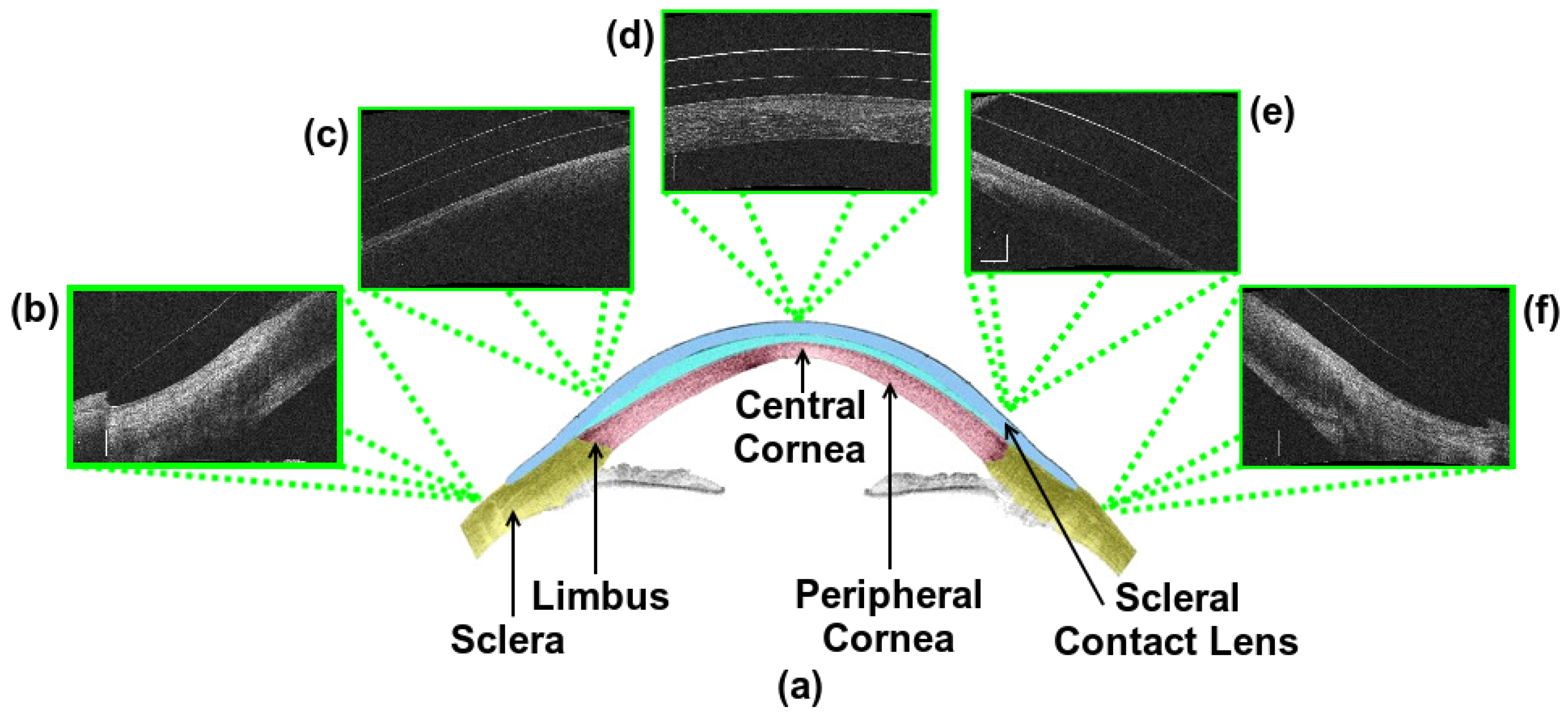 Sensors 19 05087 g001