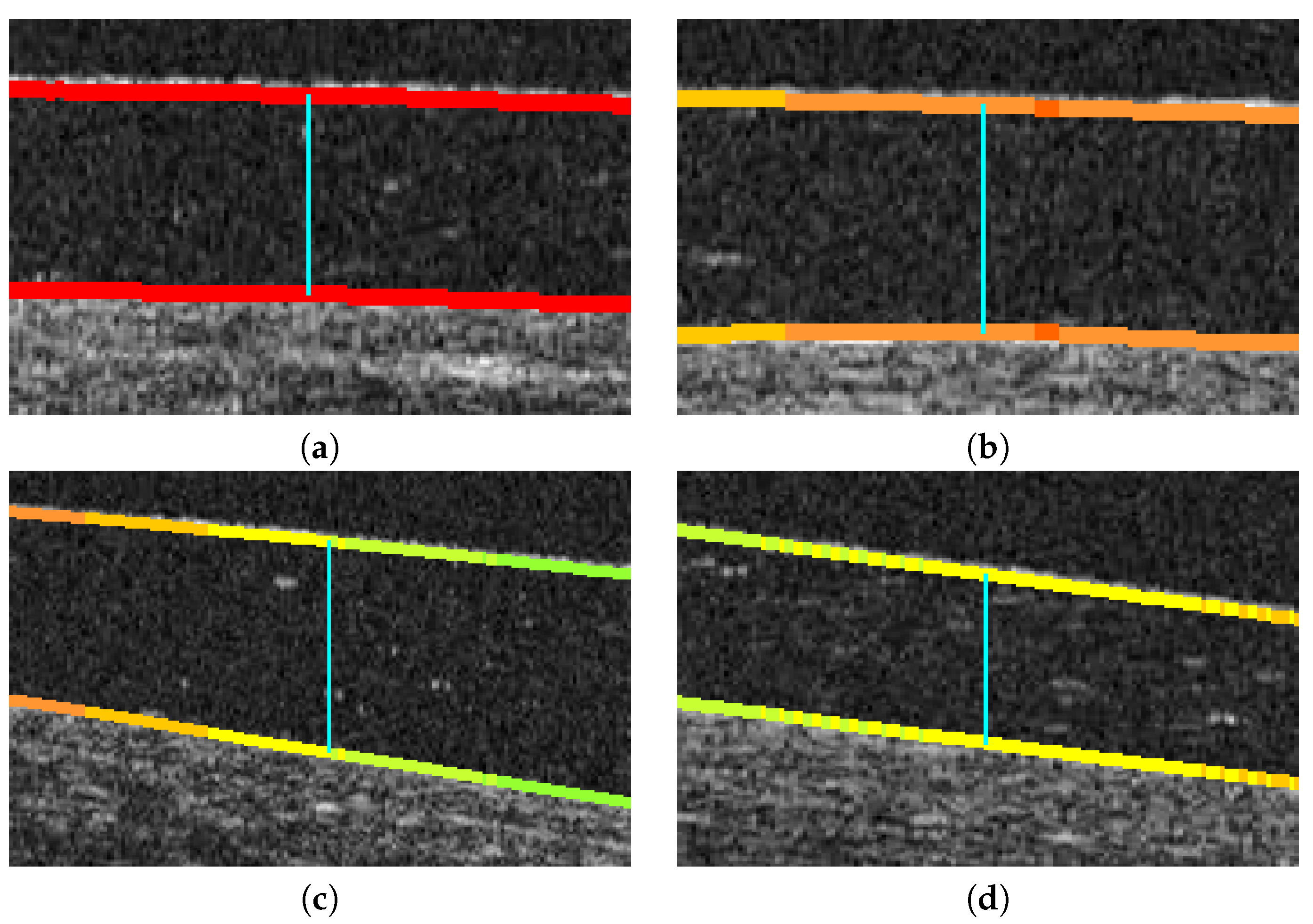 Sensors 19 05087 g010