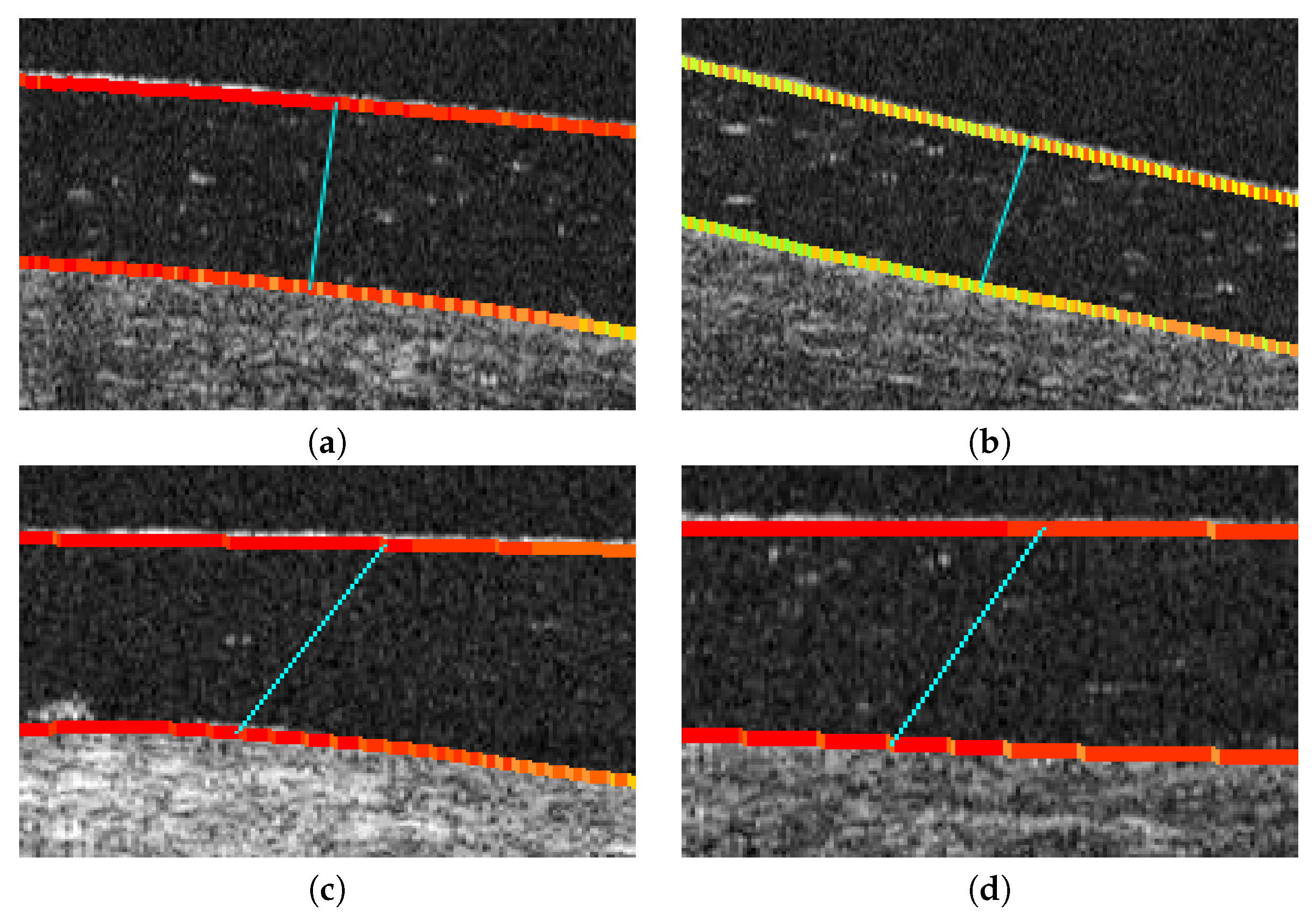 Sensors 19 05087 g011