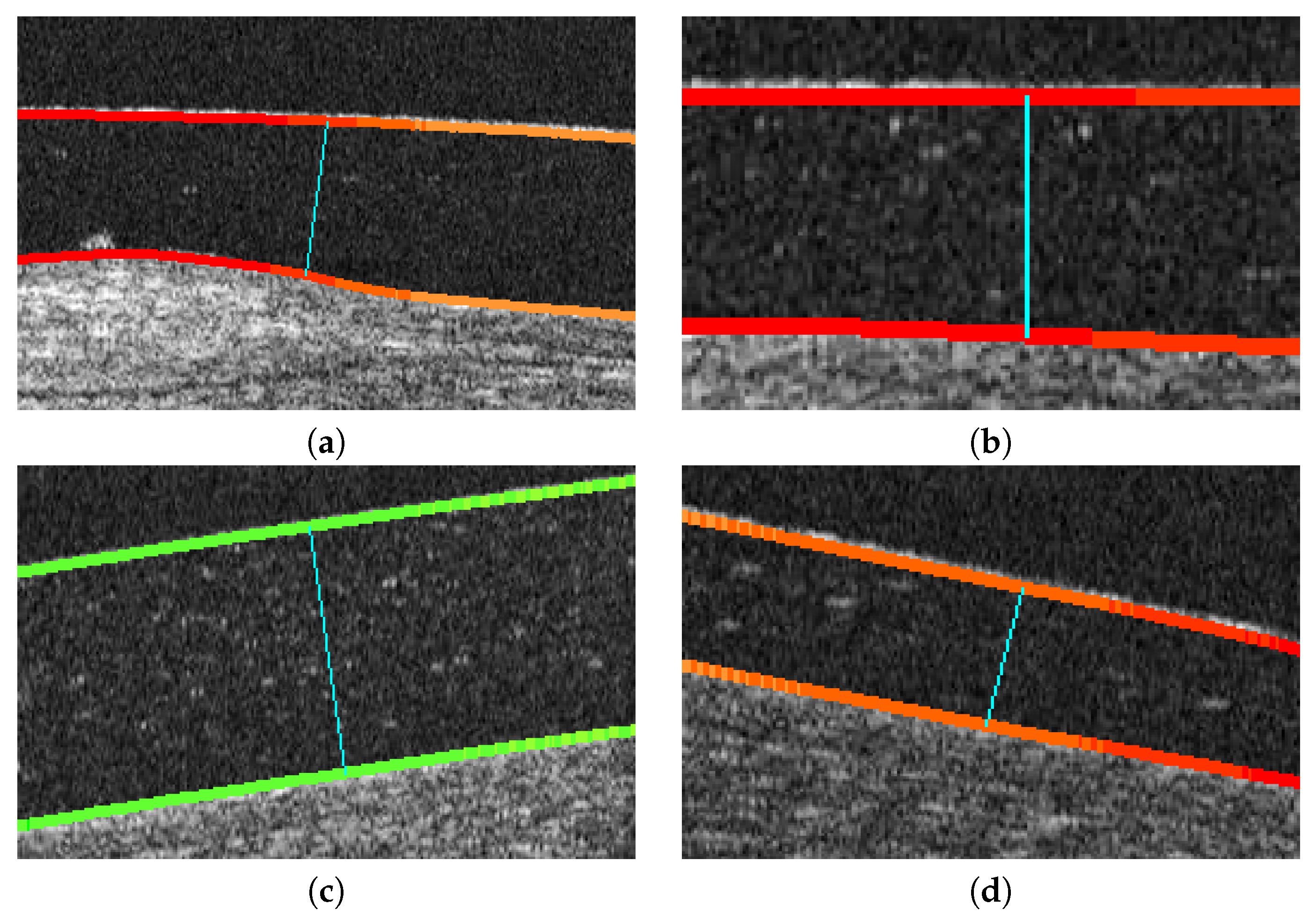 Sensors 19 05087 g012