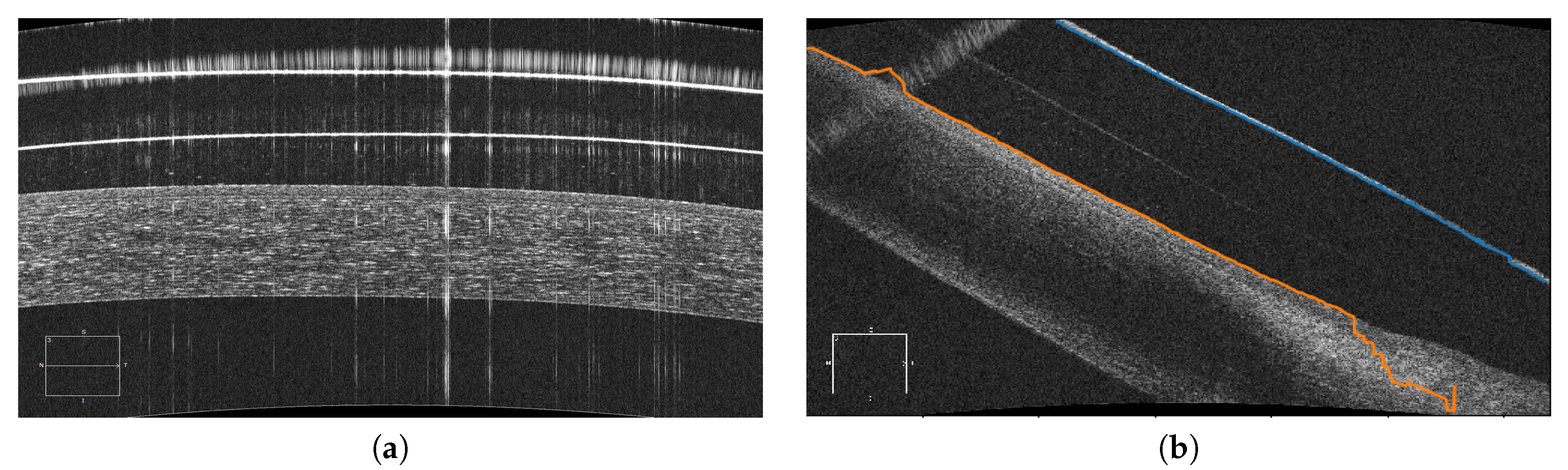 Sensors 19 05087 g016
