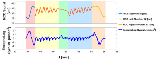 Sensors 19 05179 g0a1
