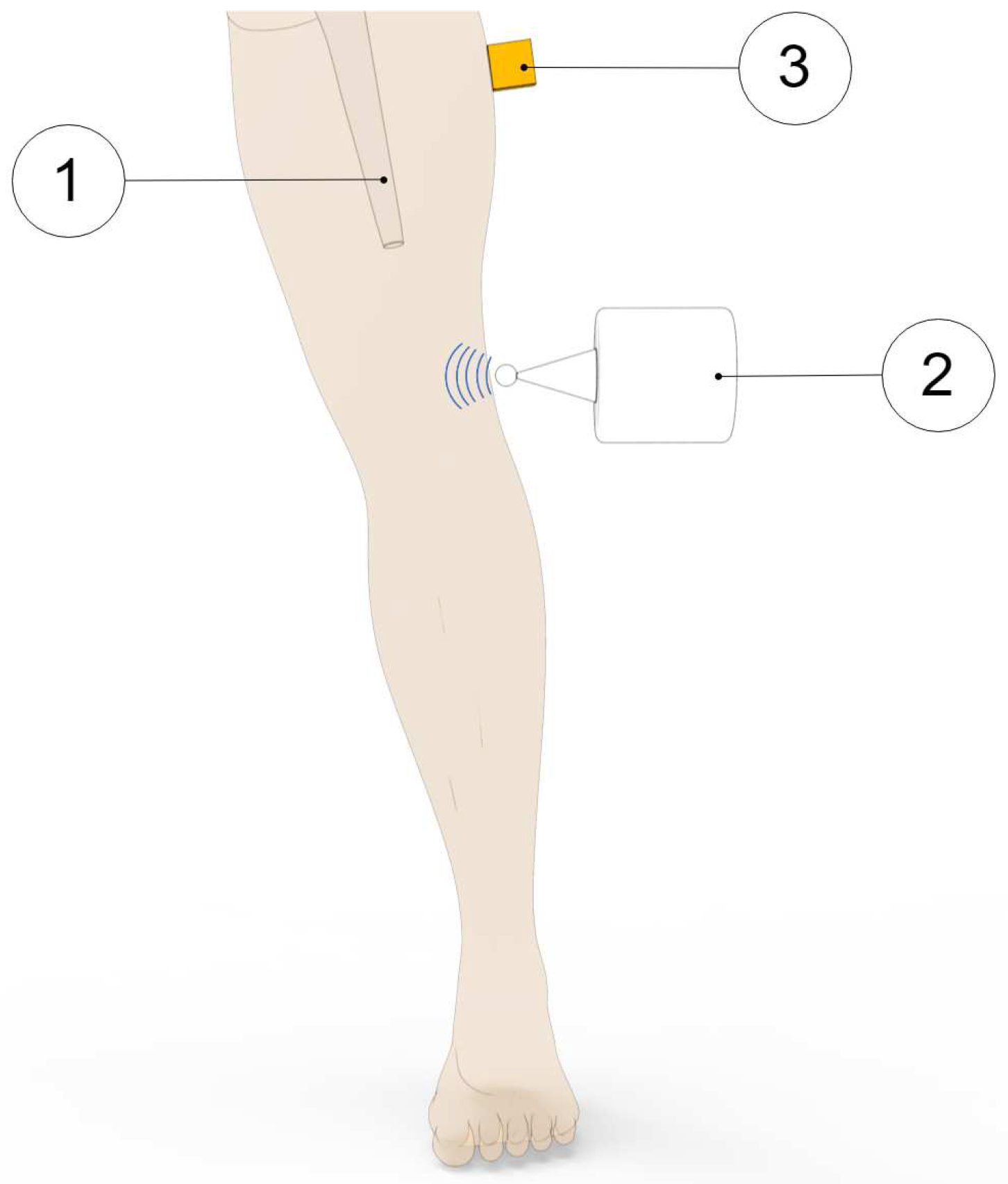 Sensors 20 00104 g003