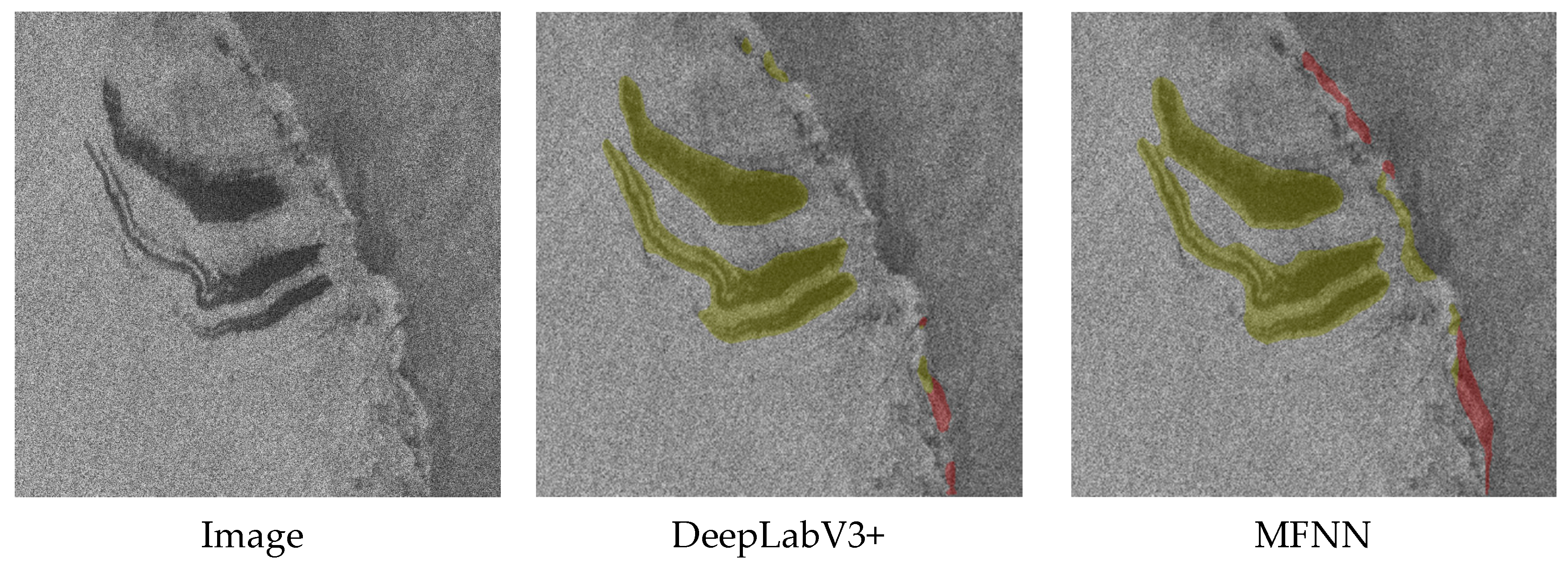 Sensors 20 00210 g011