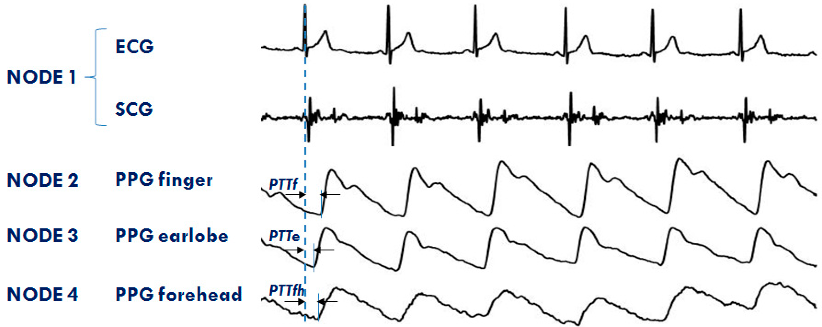 Sensors 20 00680 g011 Sensors 20 00680 g011