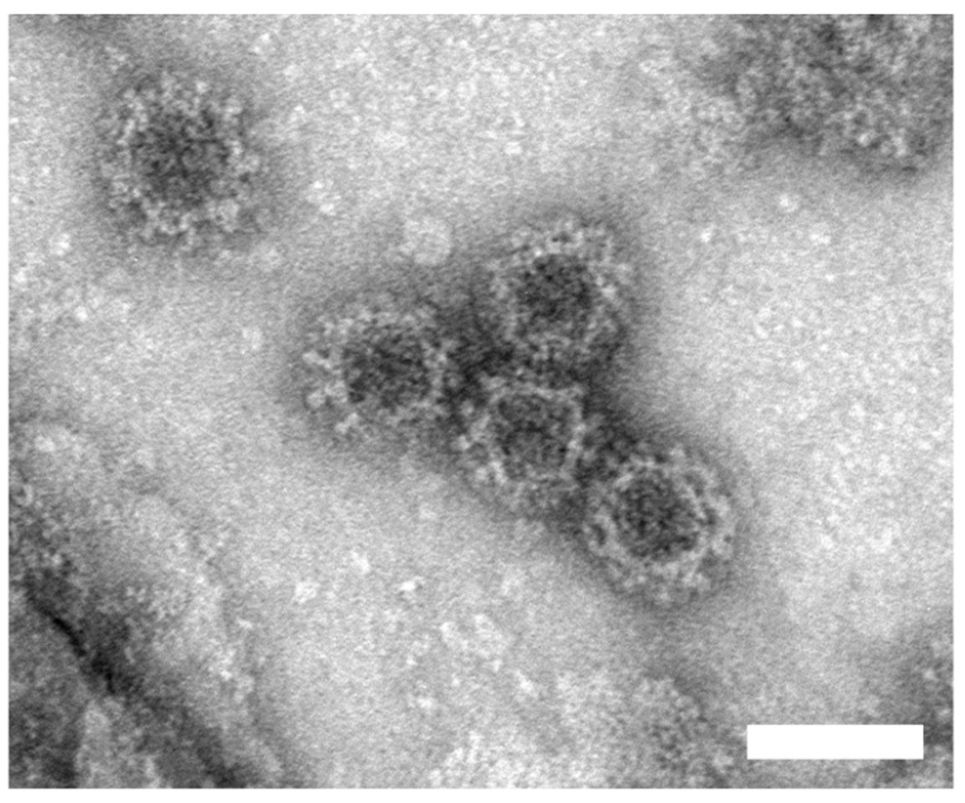 Sensors 20 00813 g004