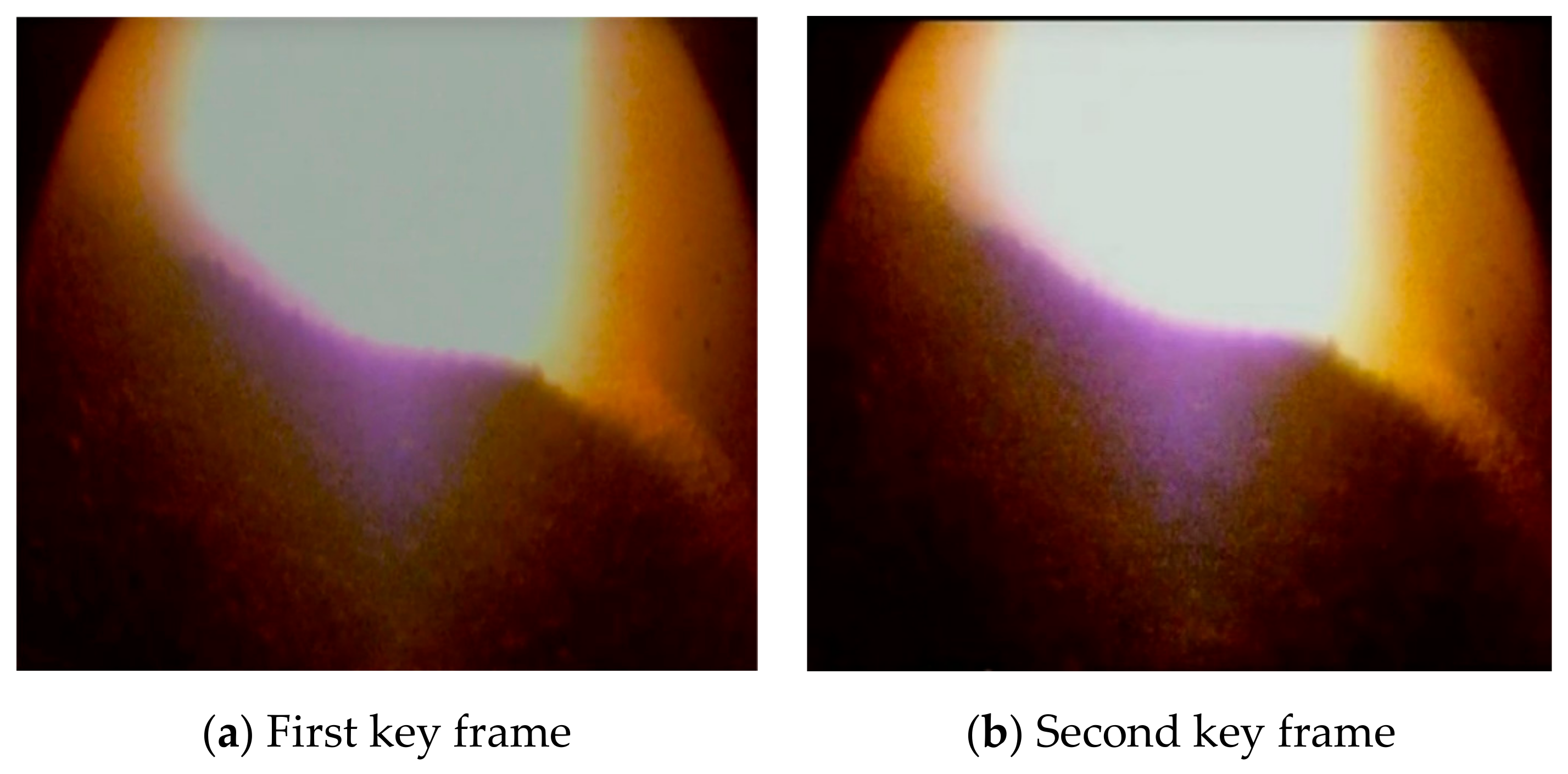 Sensors 20 00869 g011 Sensors 20 00869 g011