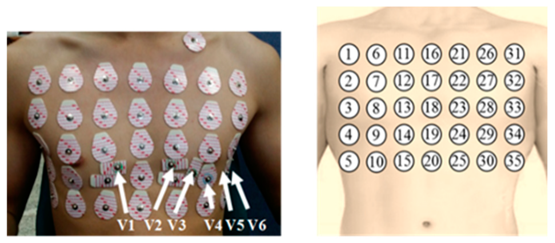 Sensors 20 00963 g001 Sensors 20 00963 g001