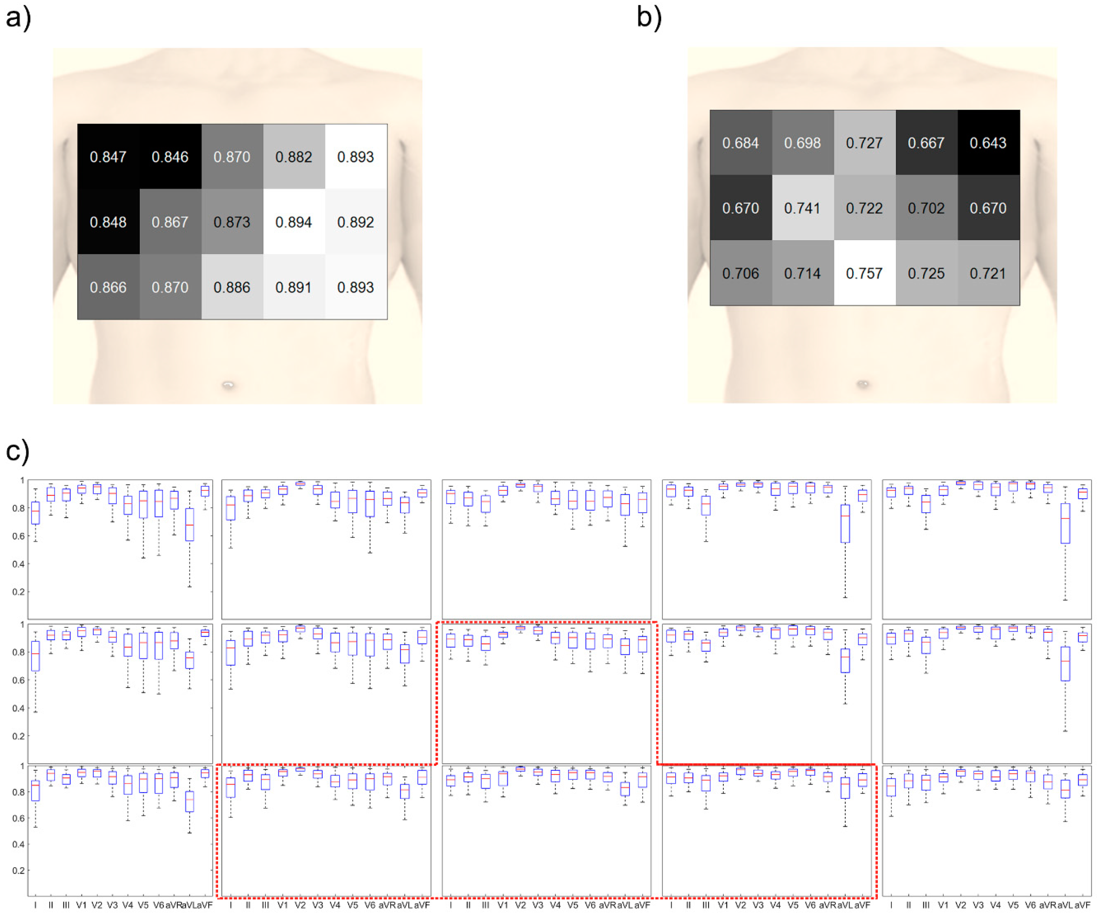 Sensors 20 00963 g007 Sensors 20 00963 g007