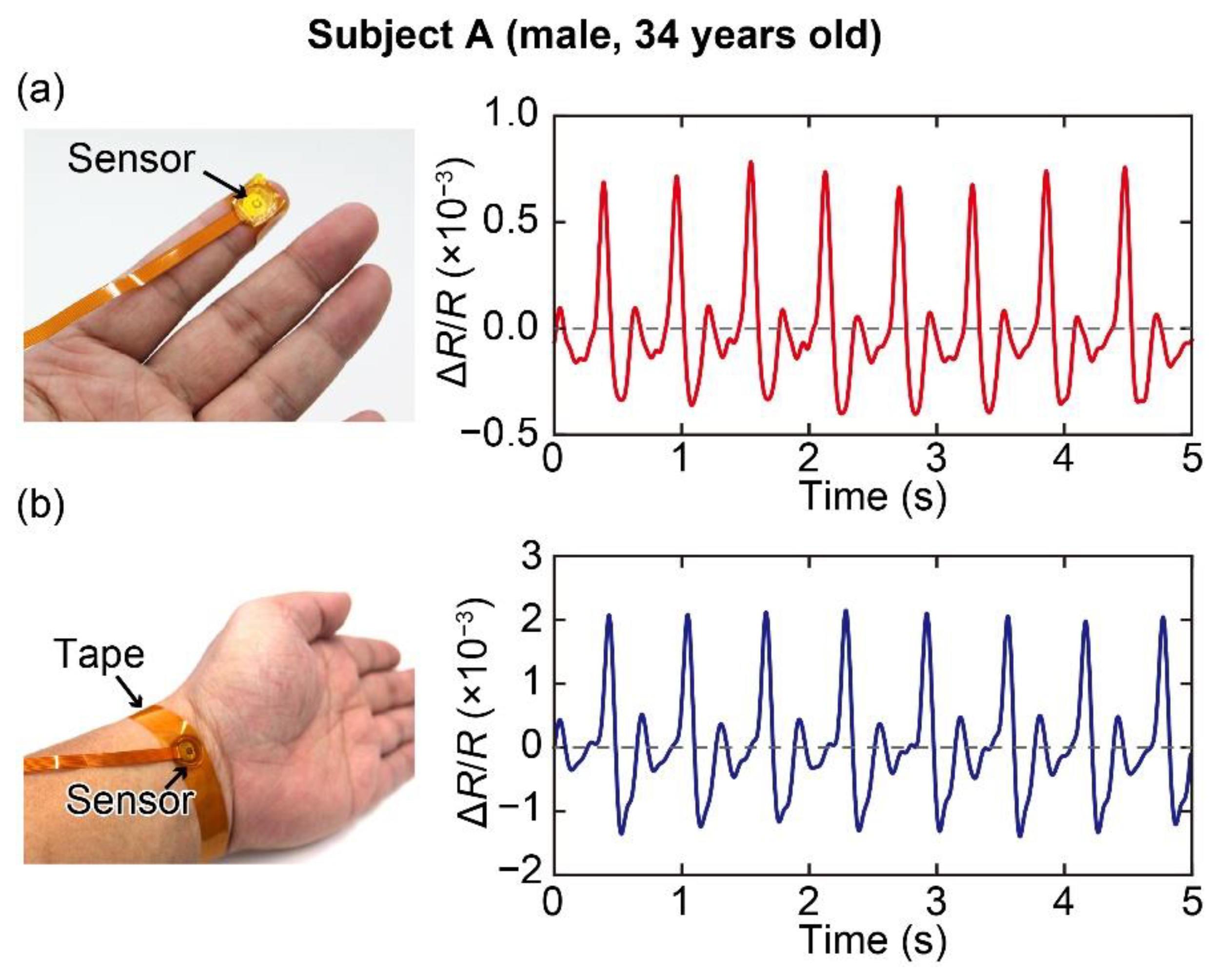 Sensors 20 01052 g004
