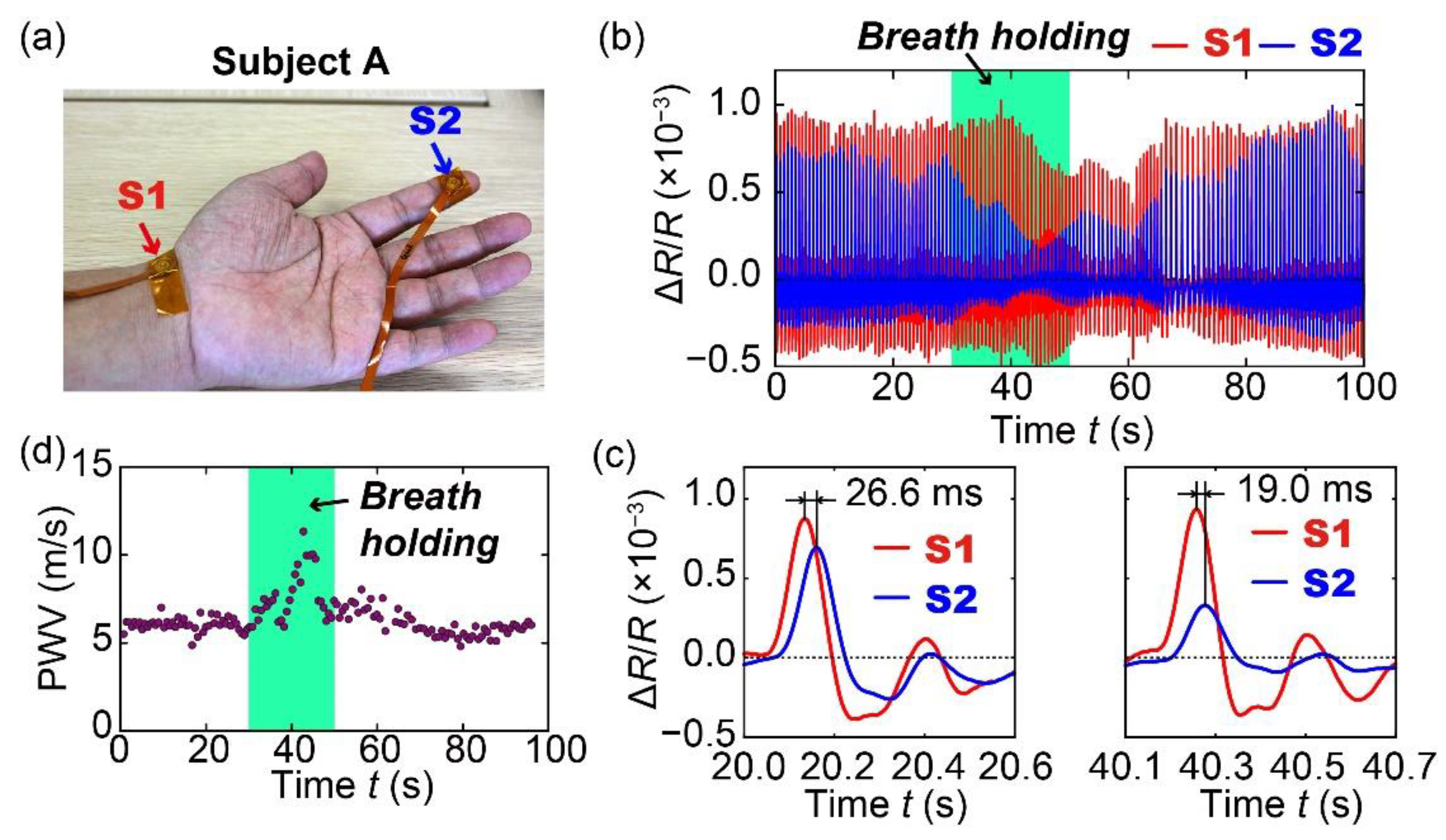 Sensors 20 01052 g007