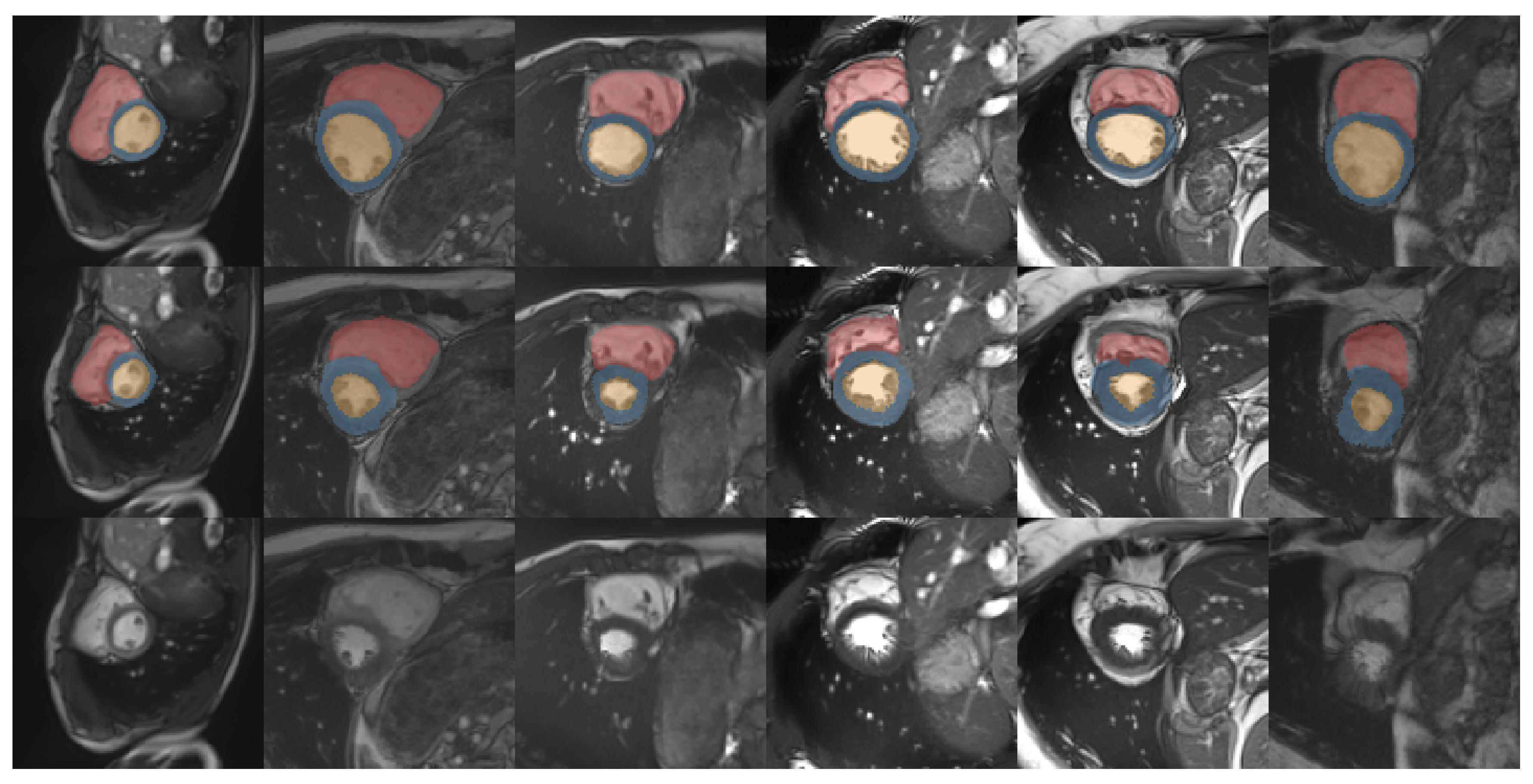 Sensors 20 01392 g008